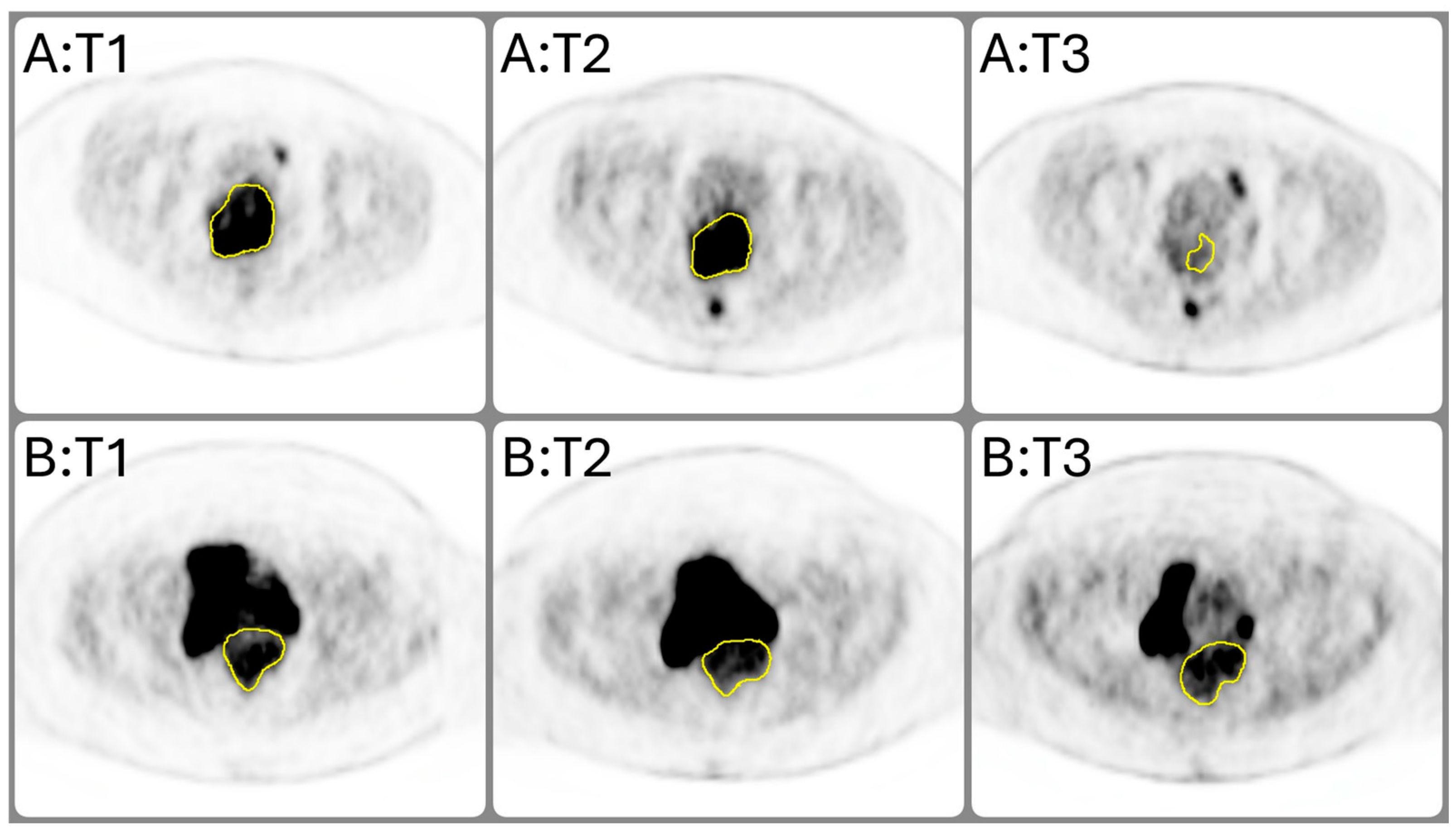 Cancers 16 03813 g002