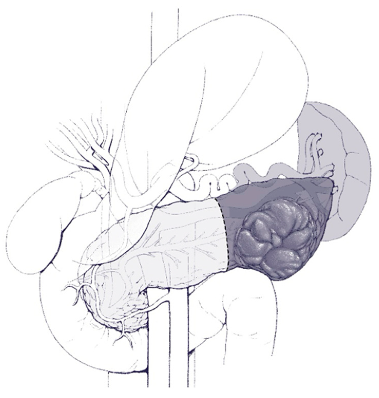 Cancers 16 03825 g004