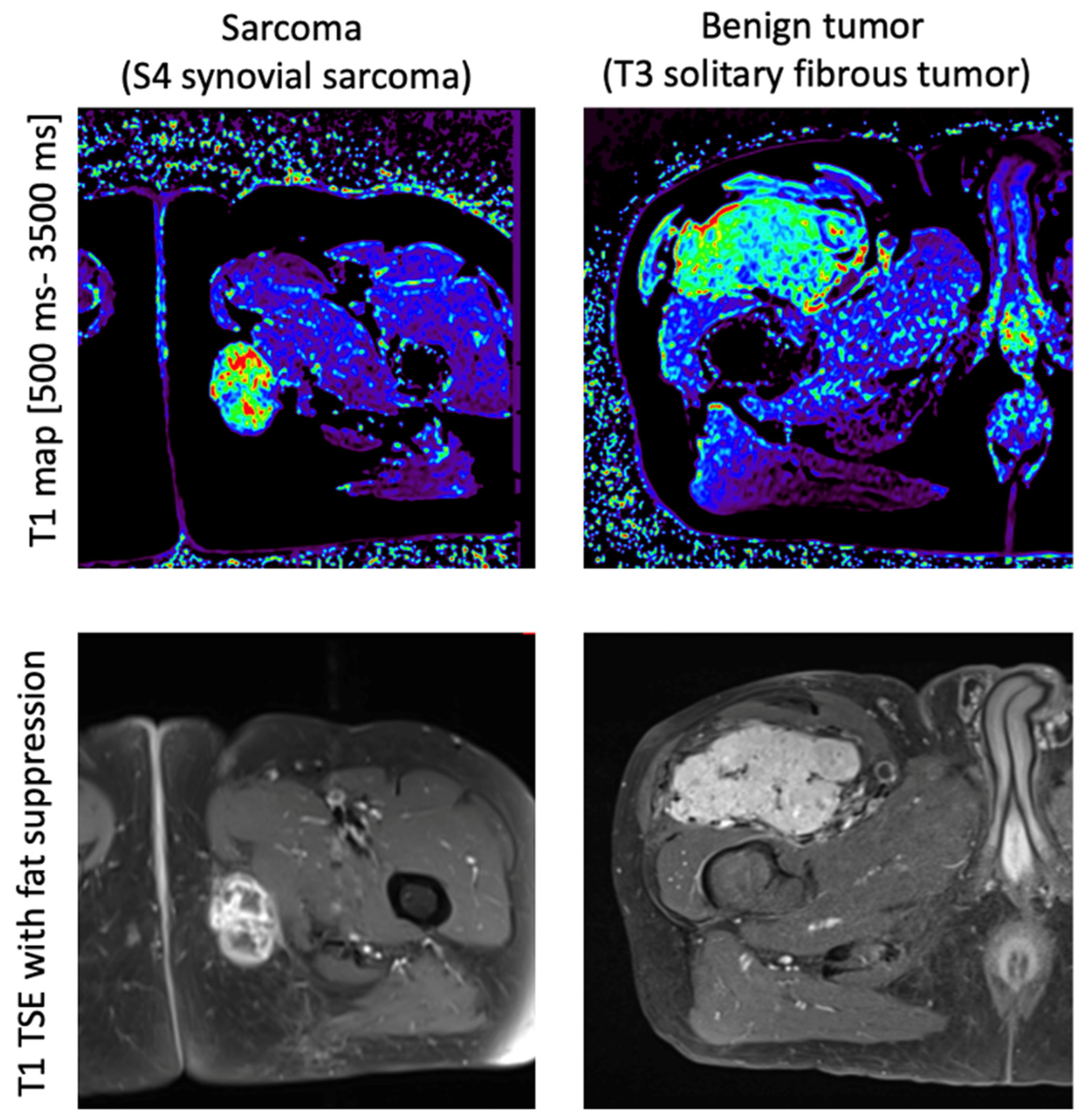 Cancers 16 03852 g002