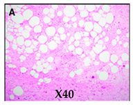 Cancers 16 03858 i001