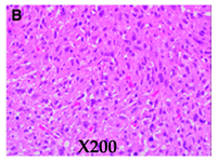 Cancers 16 03858 i002