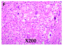 Cancers 16 03858 i004