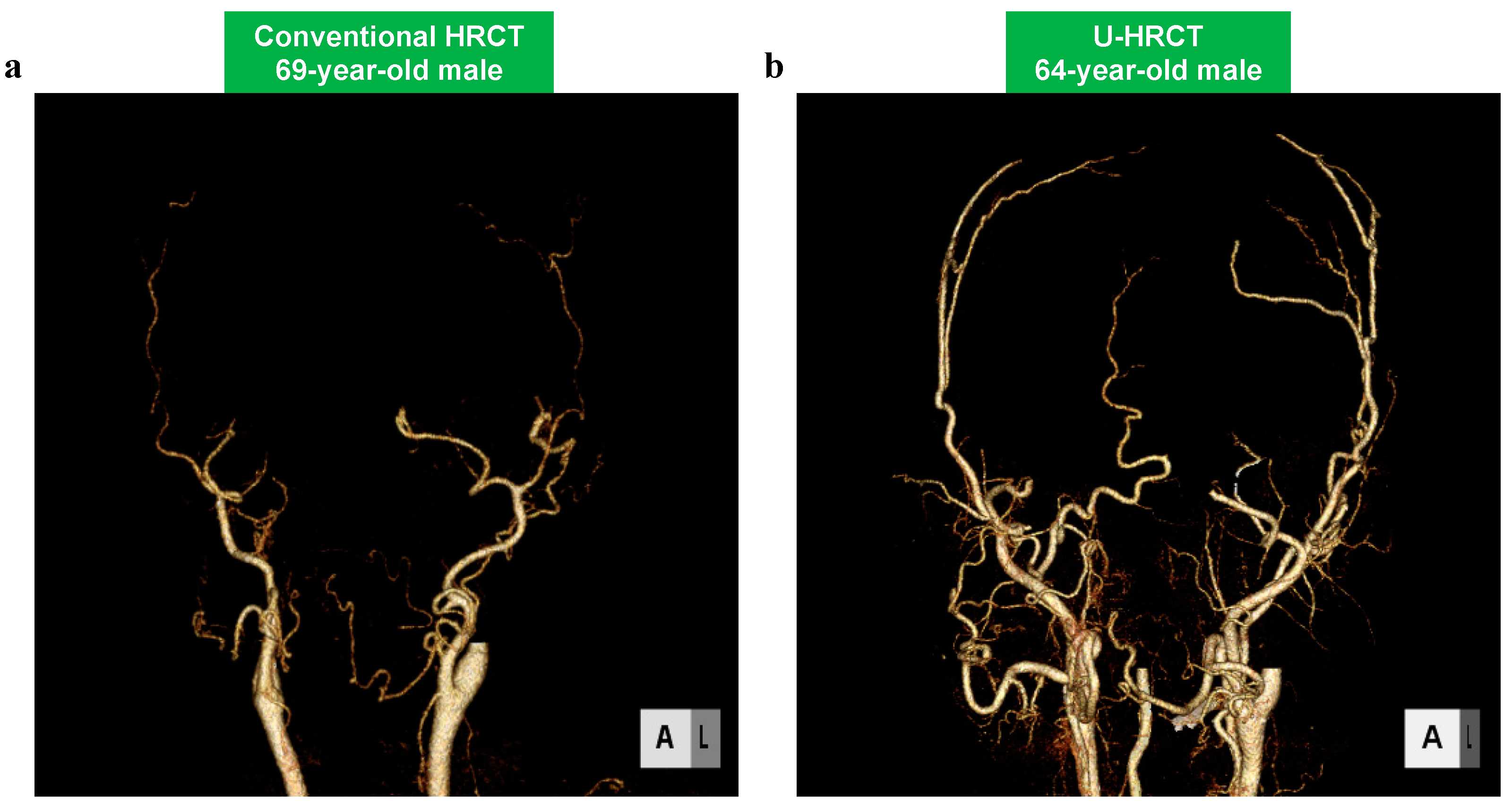 Cancers 16 03866 g003
