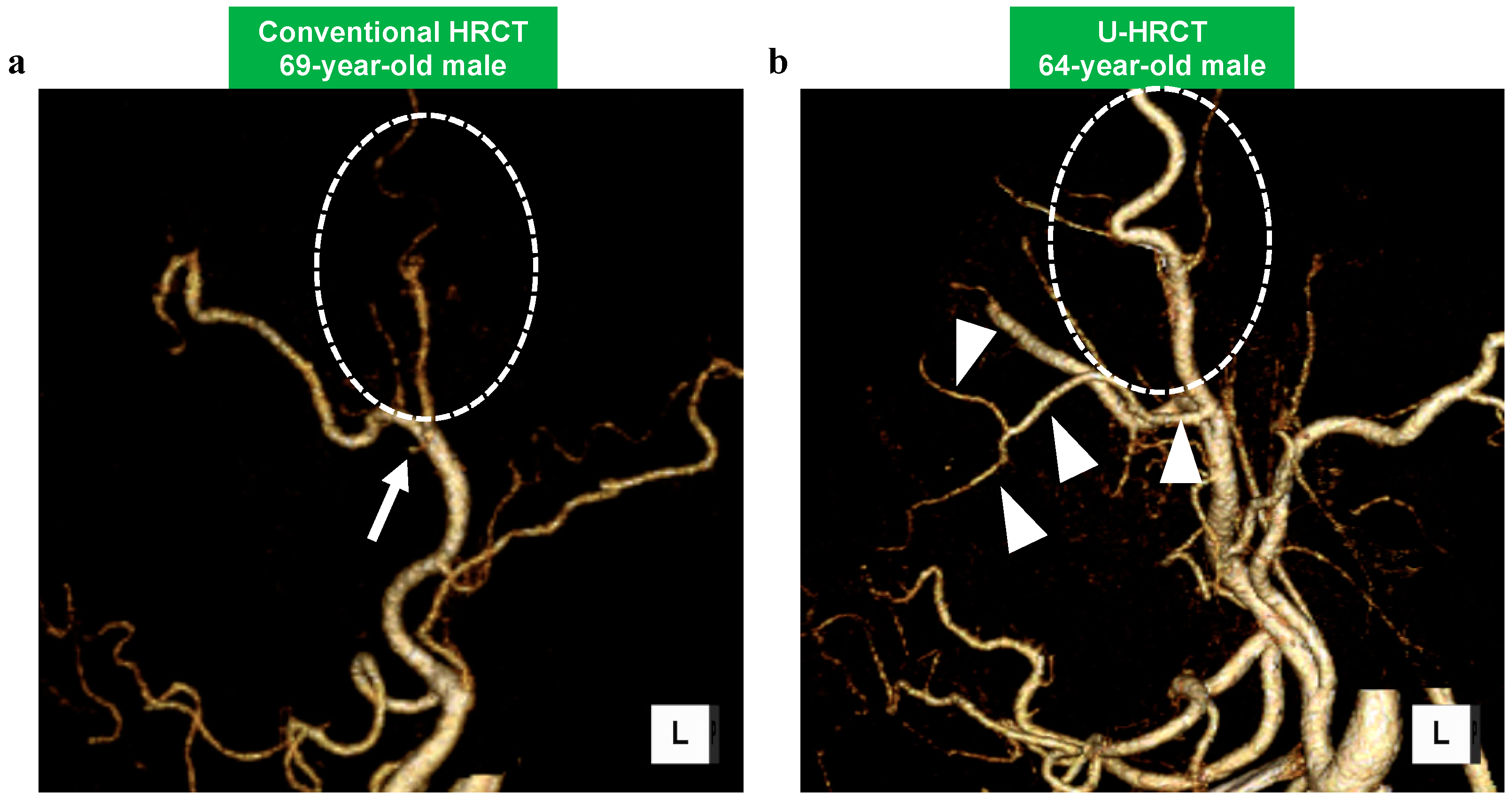 Cancers 16 03866 g004