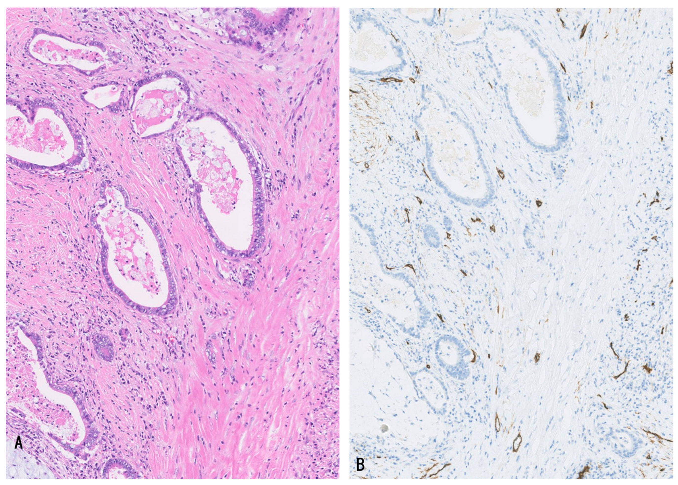 Cancers 16 03869 g002