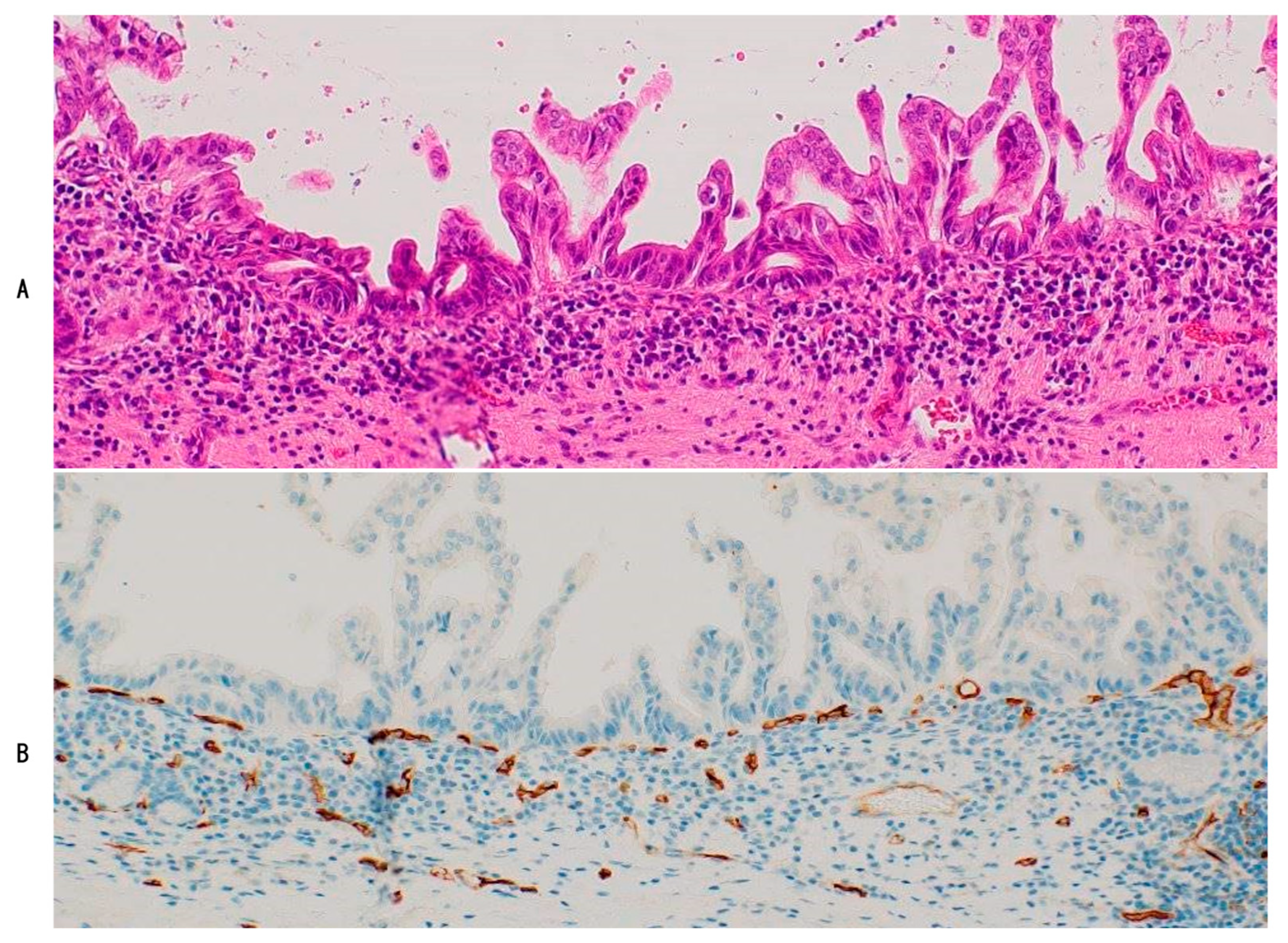 Cancers 16 03869 g003