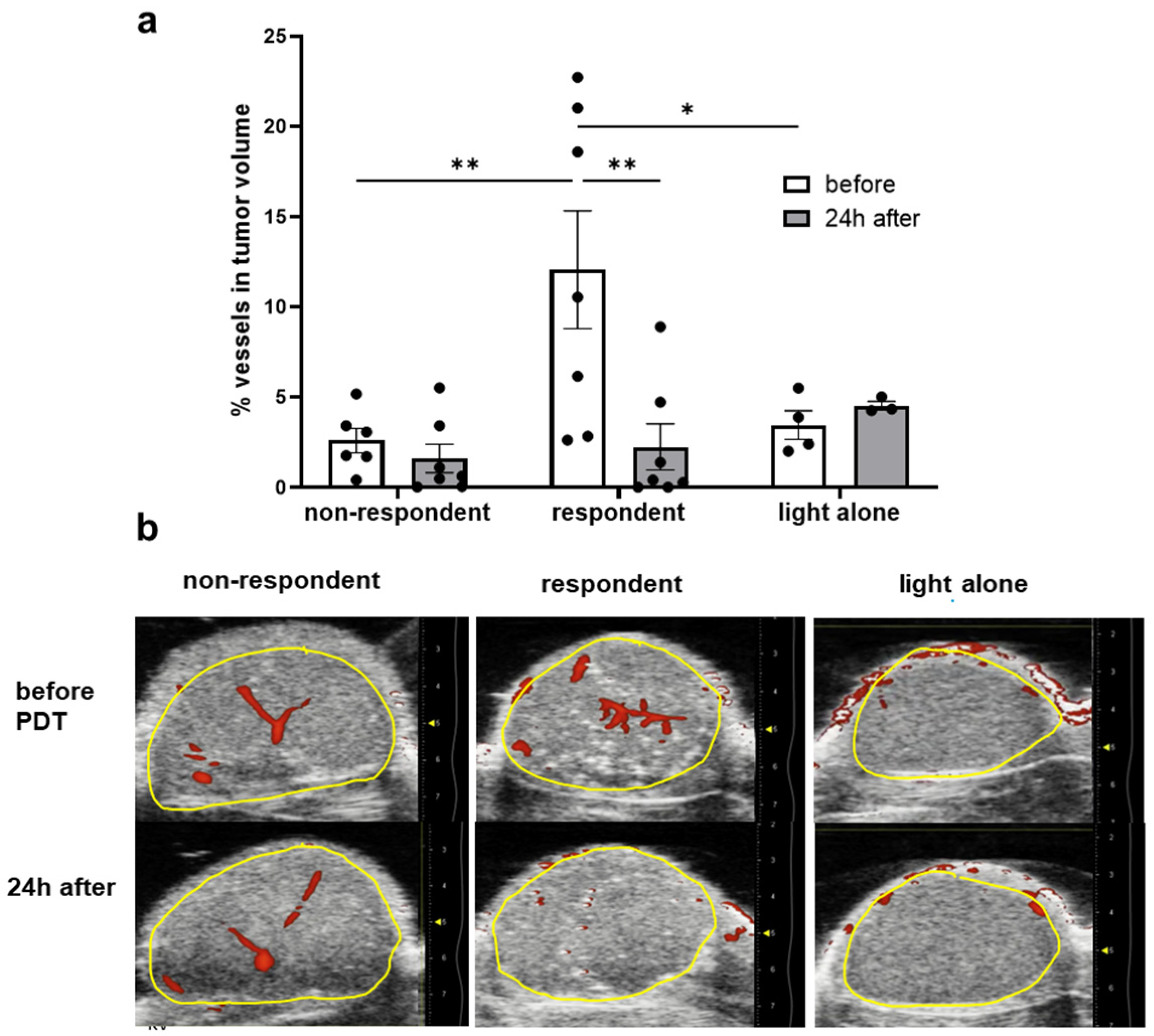 Cancers 16 03924 g007 Cancers 16 03924 g007