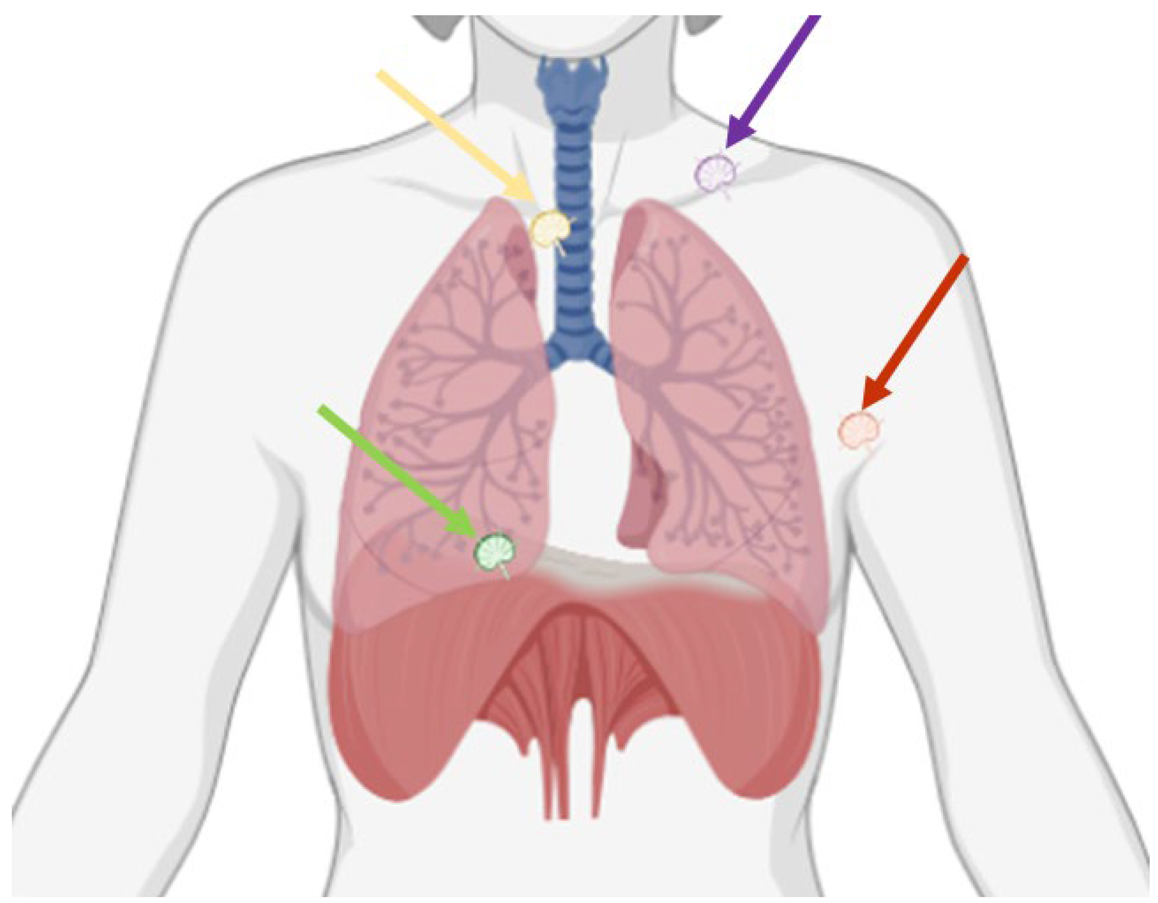 Cancers 16 03985 g001