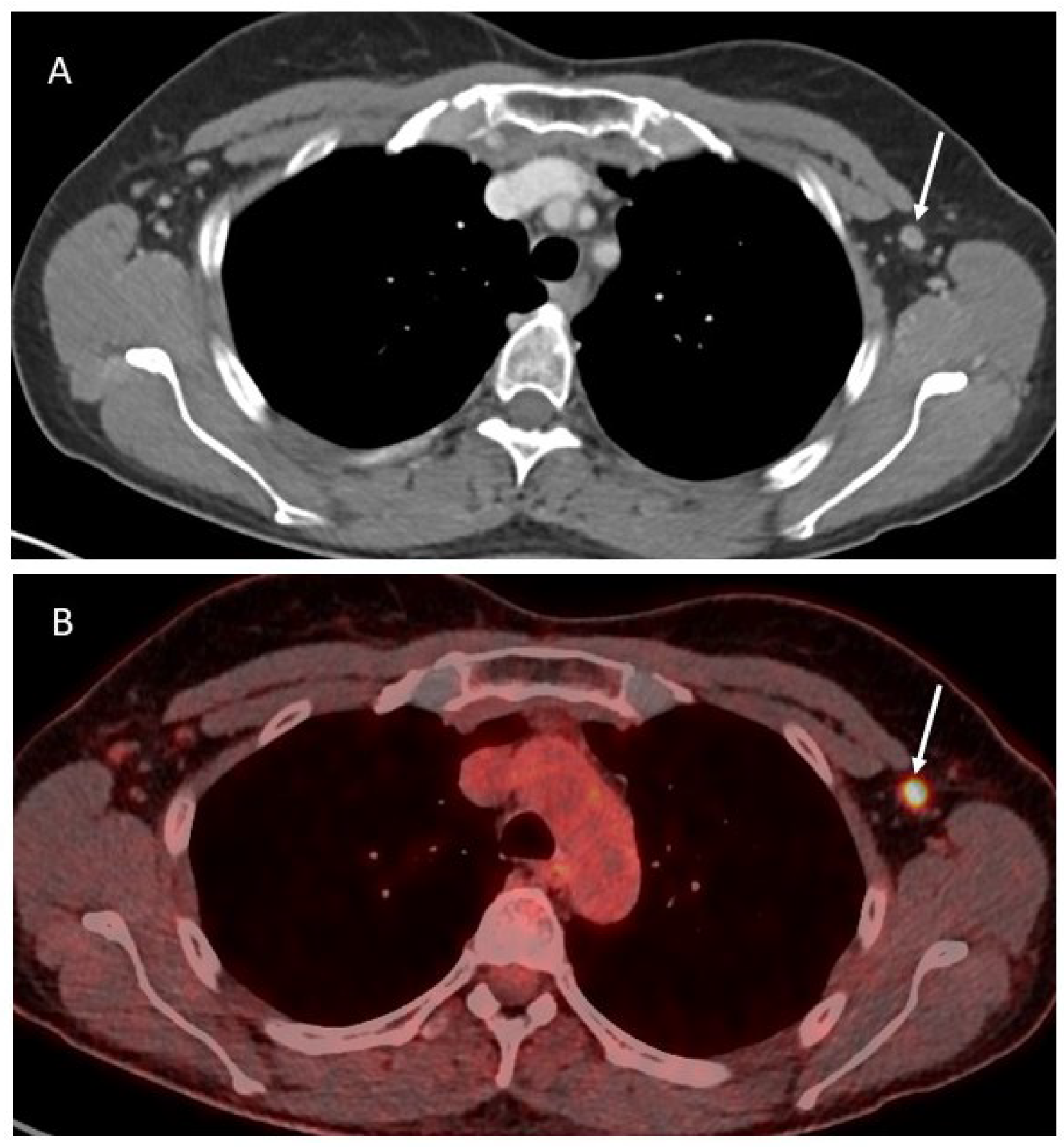 Cancers 16 03985 g002