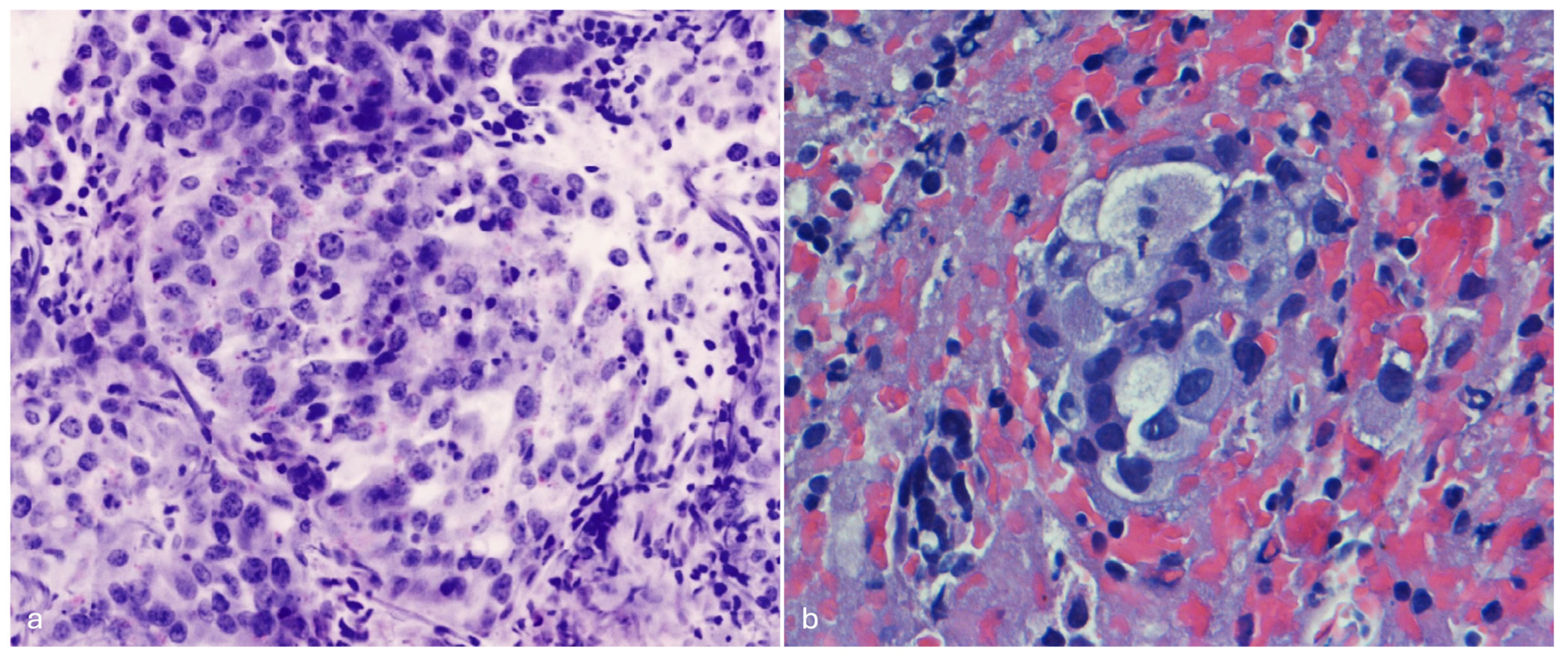 Cancers 16 04015 g002