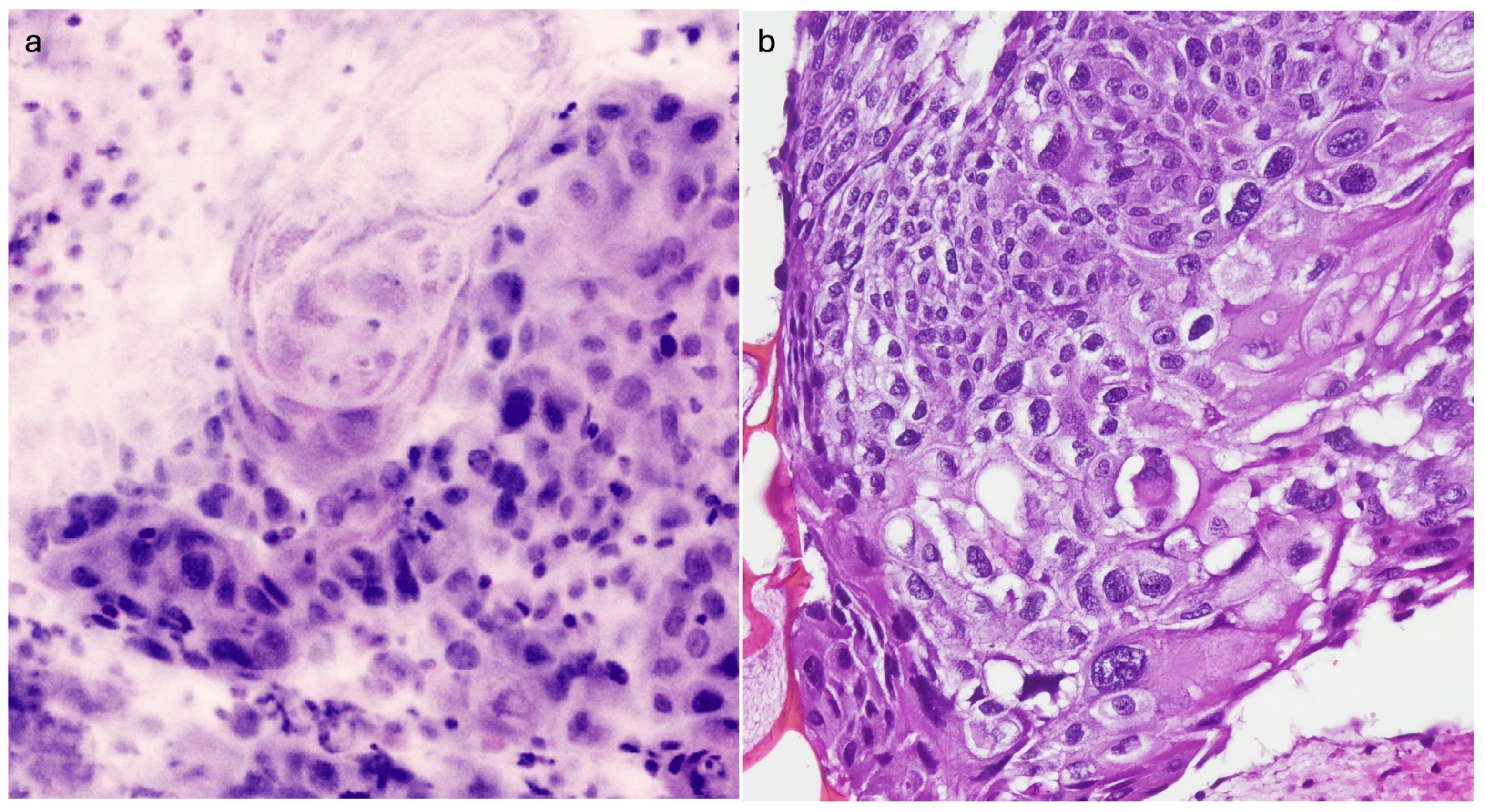 Cancers 16 04015 g003