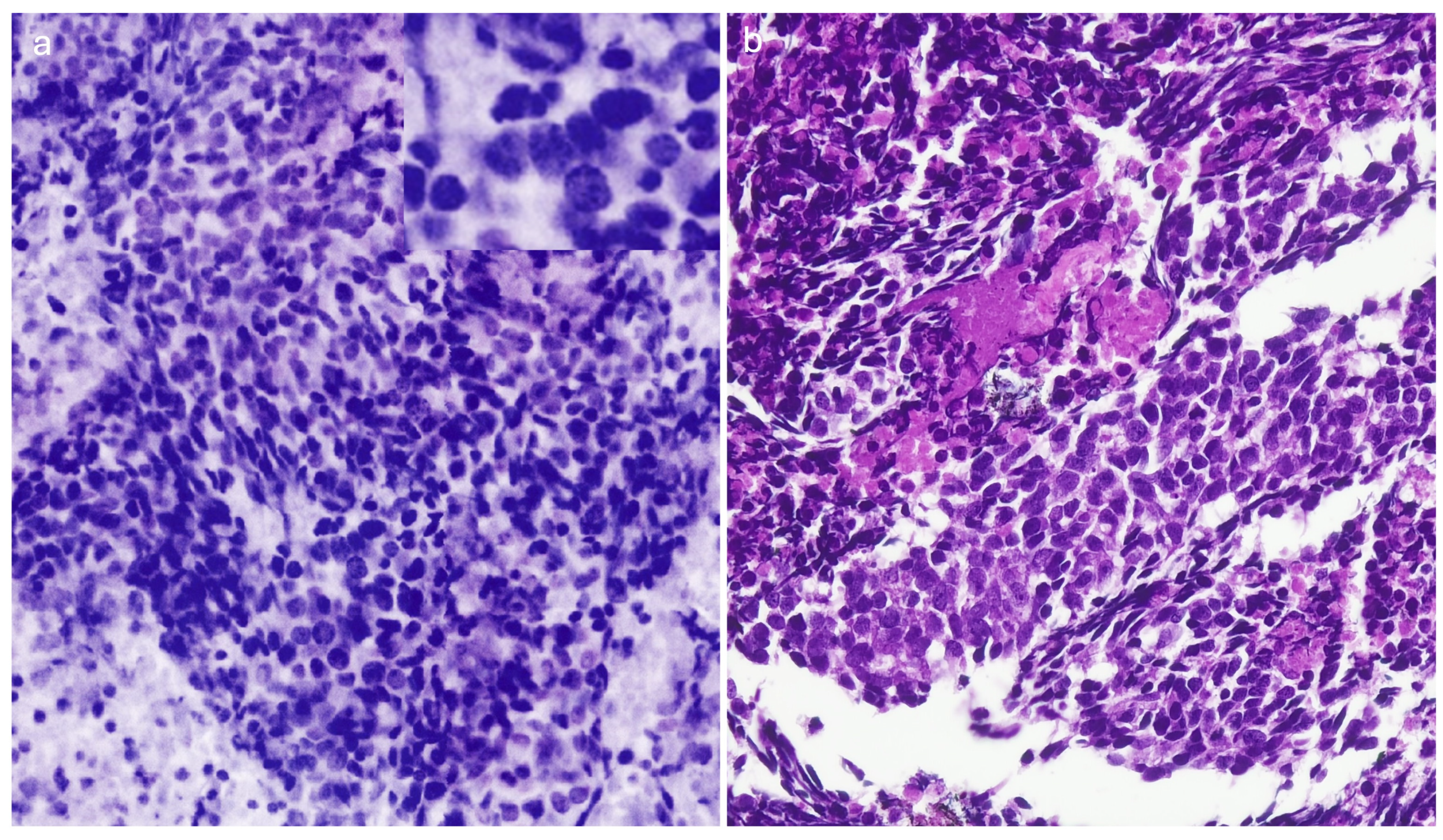 Cancers 16 04015 g004