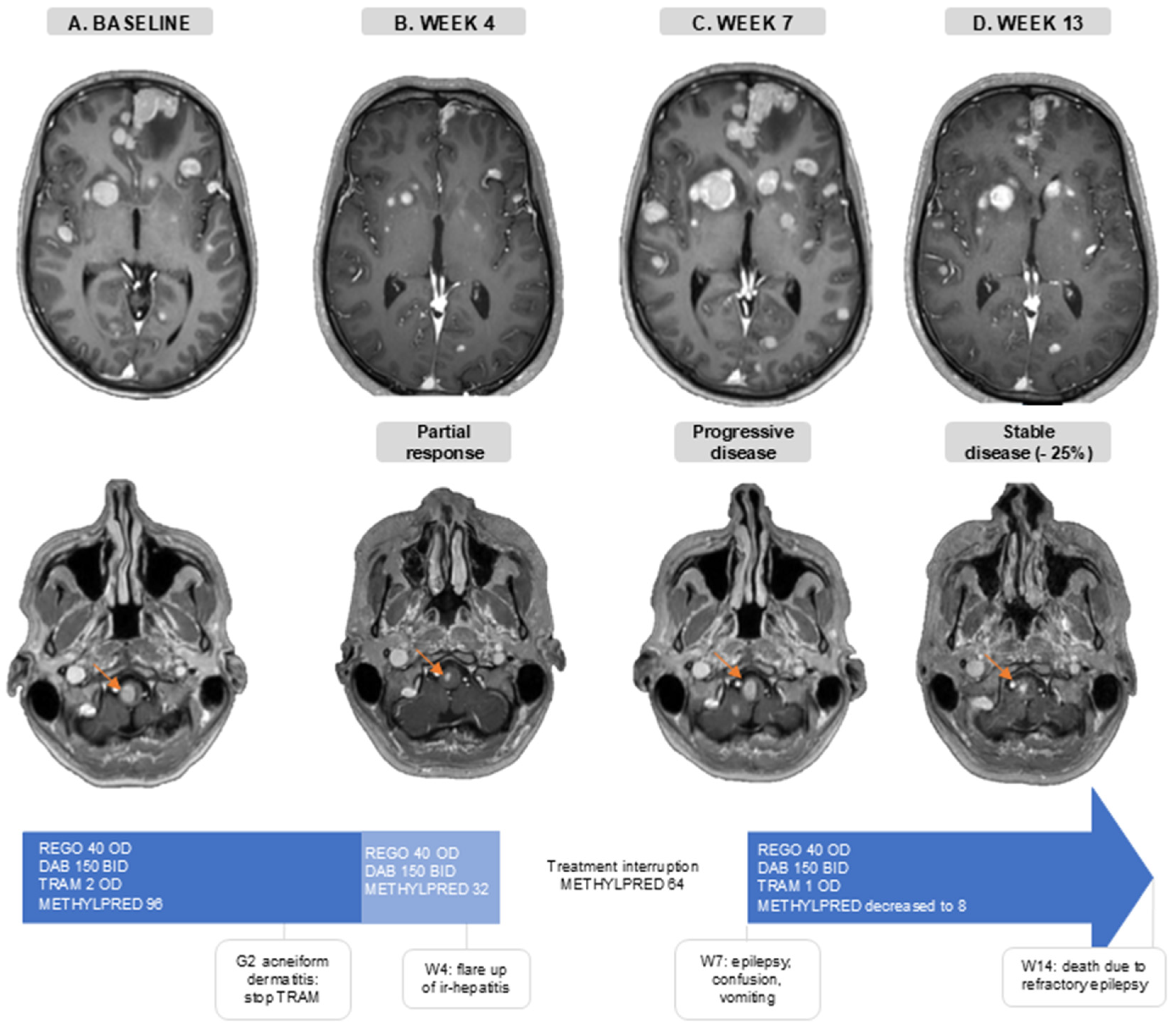 Cancers 16 04083 g004