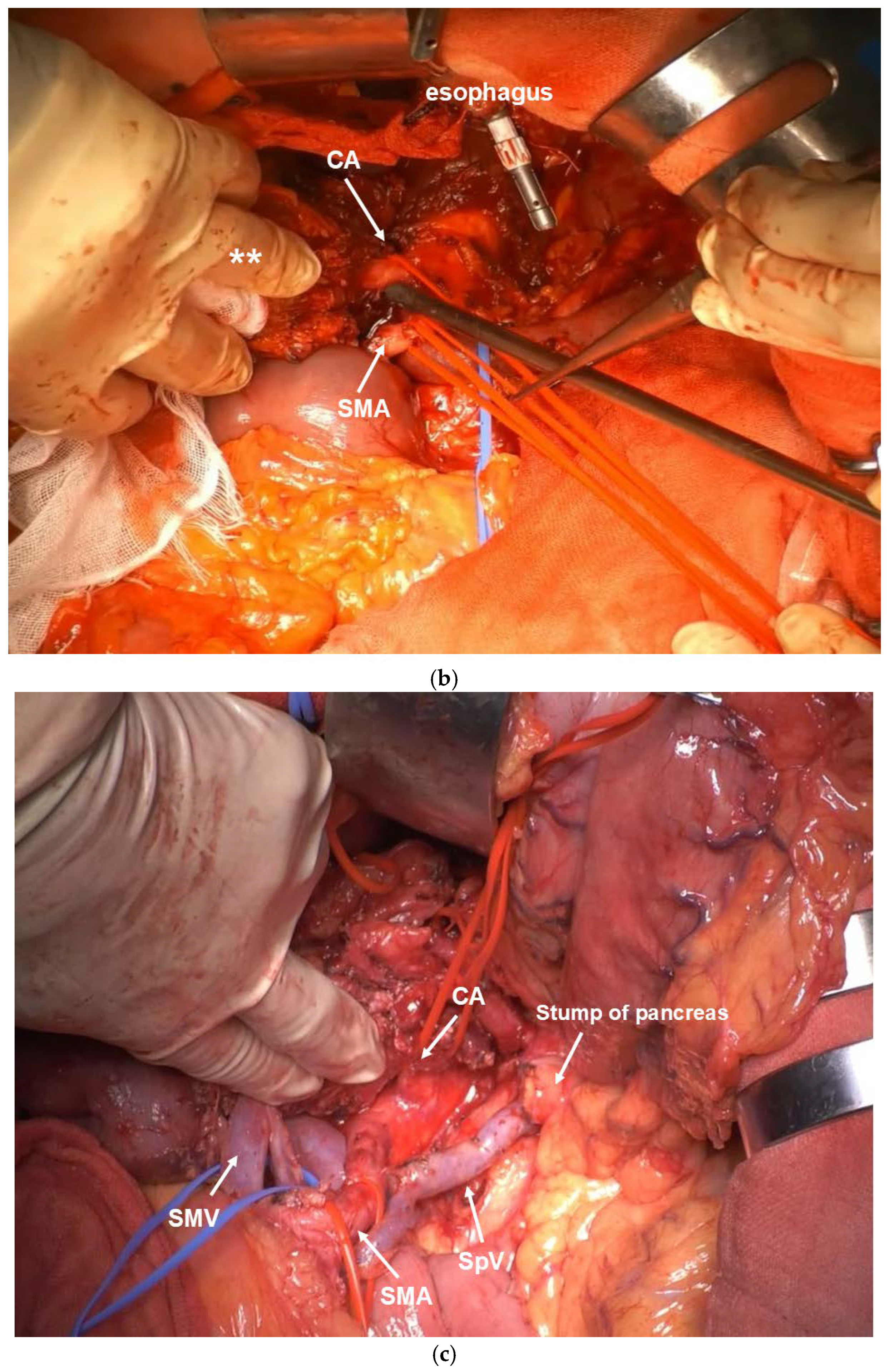 Cancers 16 04115 g002b