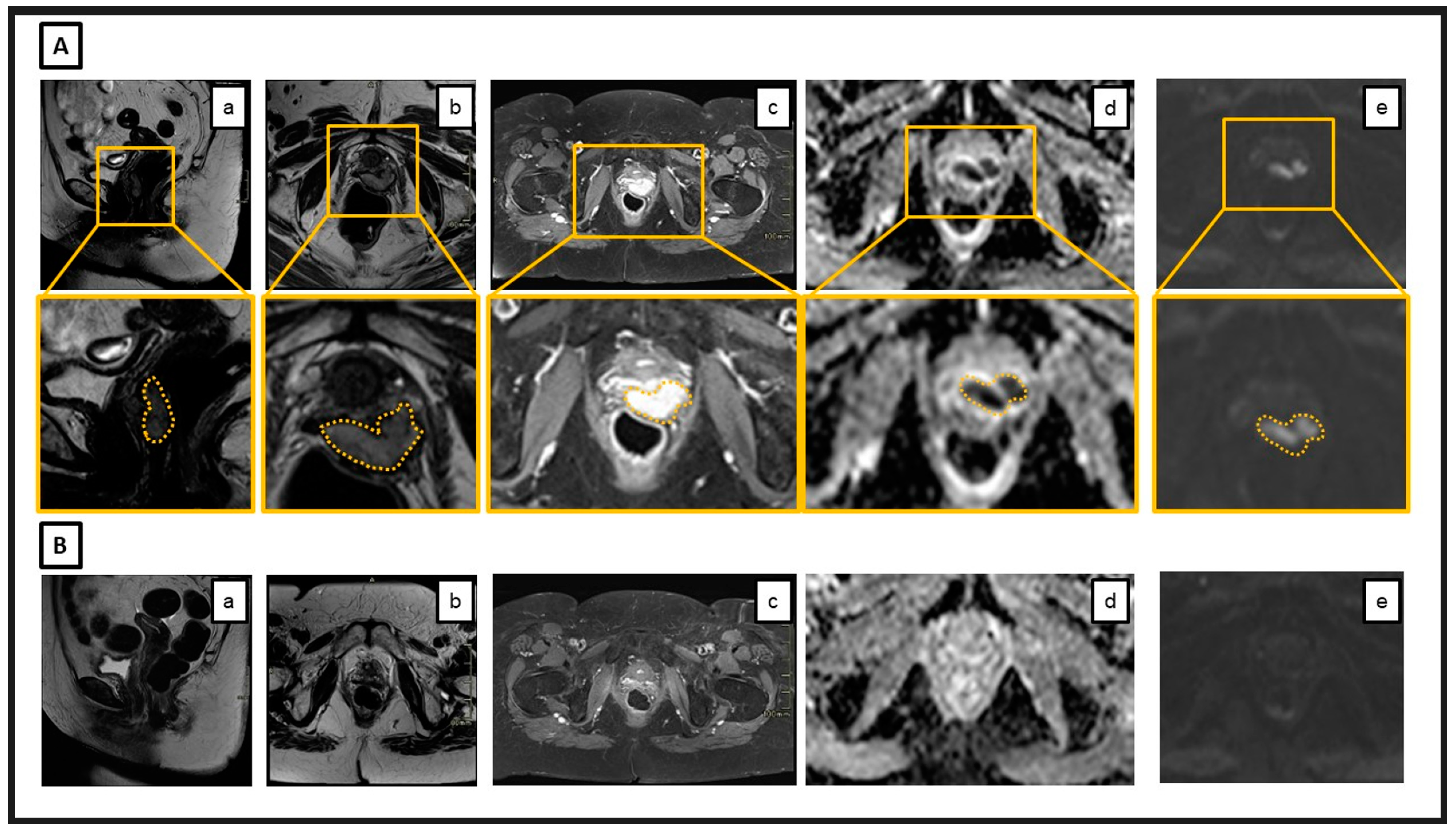 Cancers 16 04147 g001