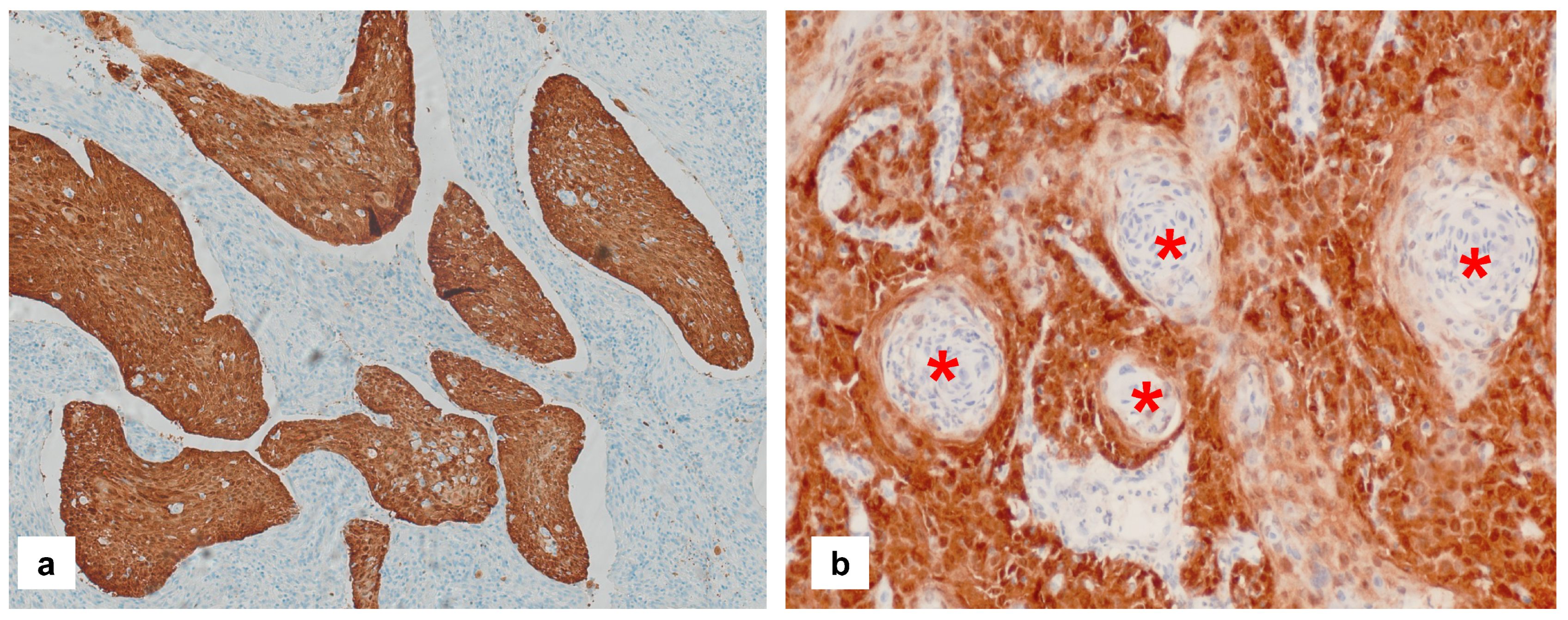 Cancers 16 04216 g003