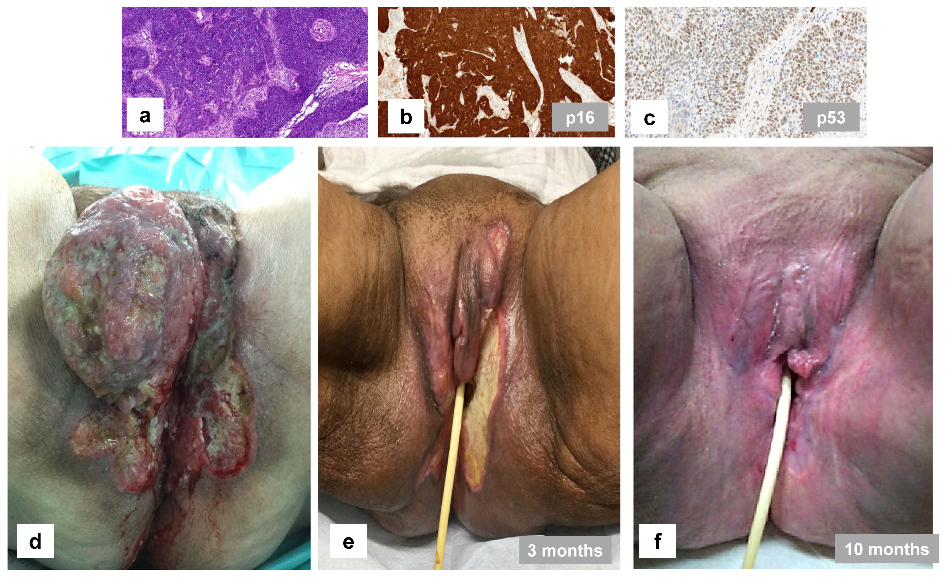 Cancers 16 04216 g007