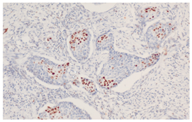 Cancers 16 04216 i001