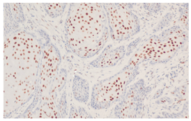 Cancers 16 04216 i002