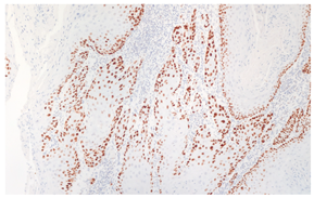 Cancers 16 04216 i003