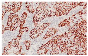 Cancers 16 04216 i004