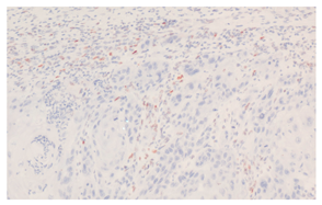 Cancers 16 04216 i005