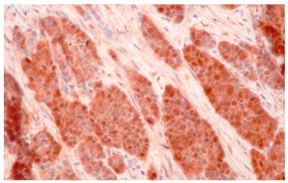 Cancers 16 04216 i006