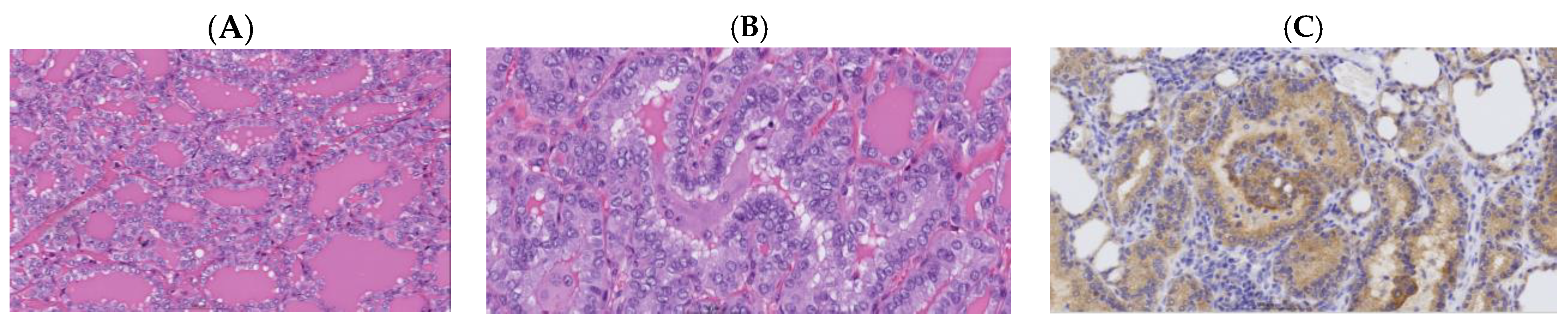 Cancers 16 04249 g002