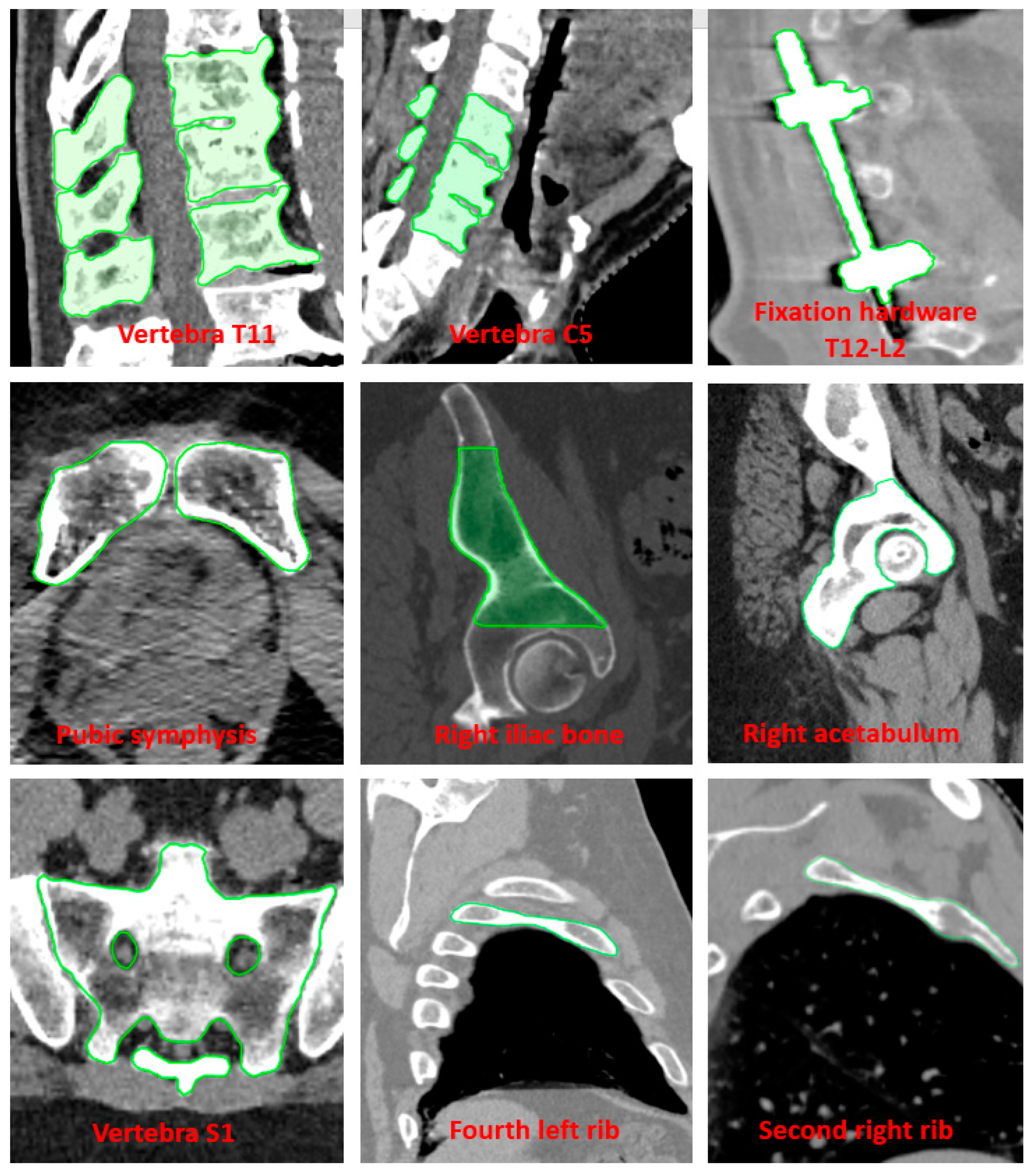 Cancers 16 04267 g002