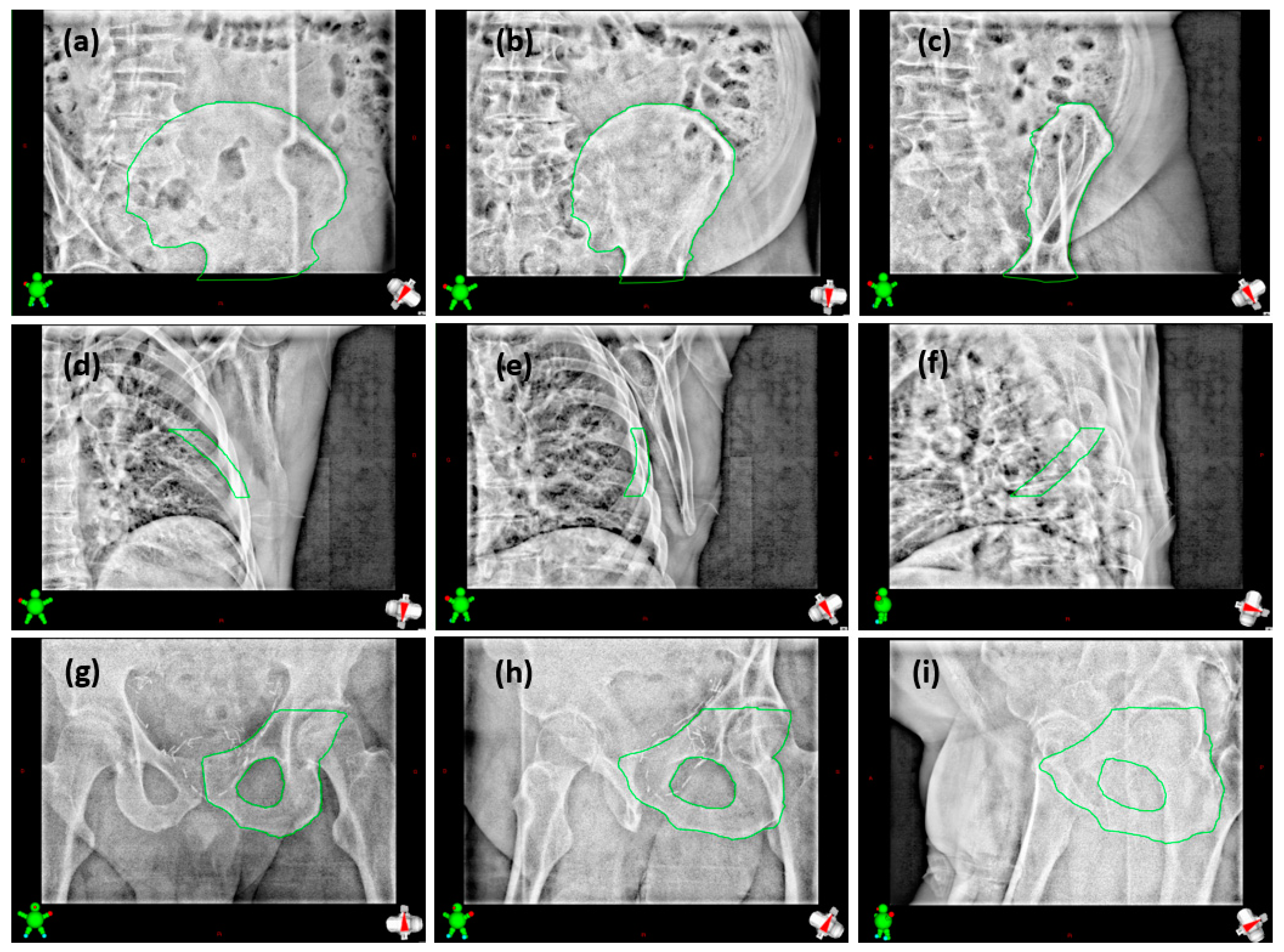 Cancers 16 04267 g003