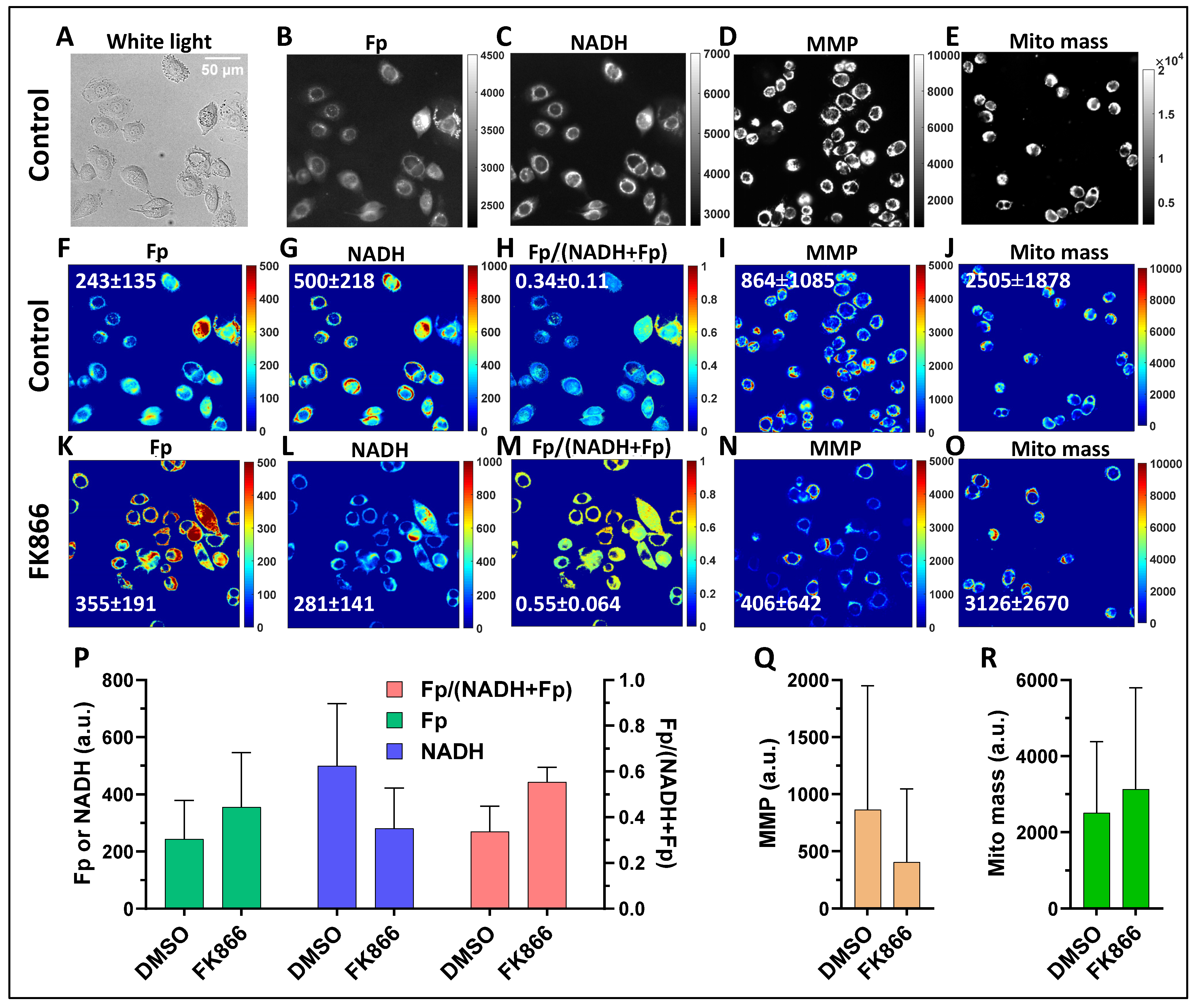 Cancers 17 00007 g002