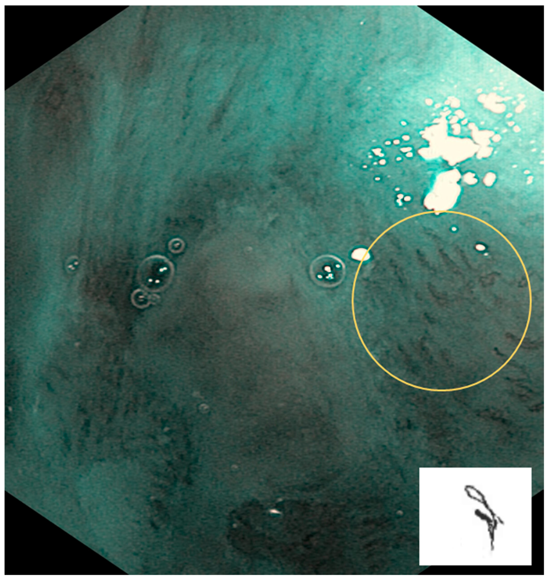 Cancers 17 00021 g003