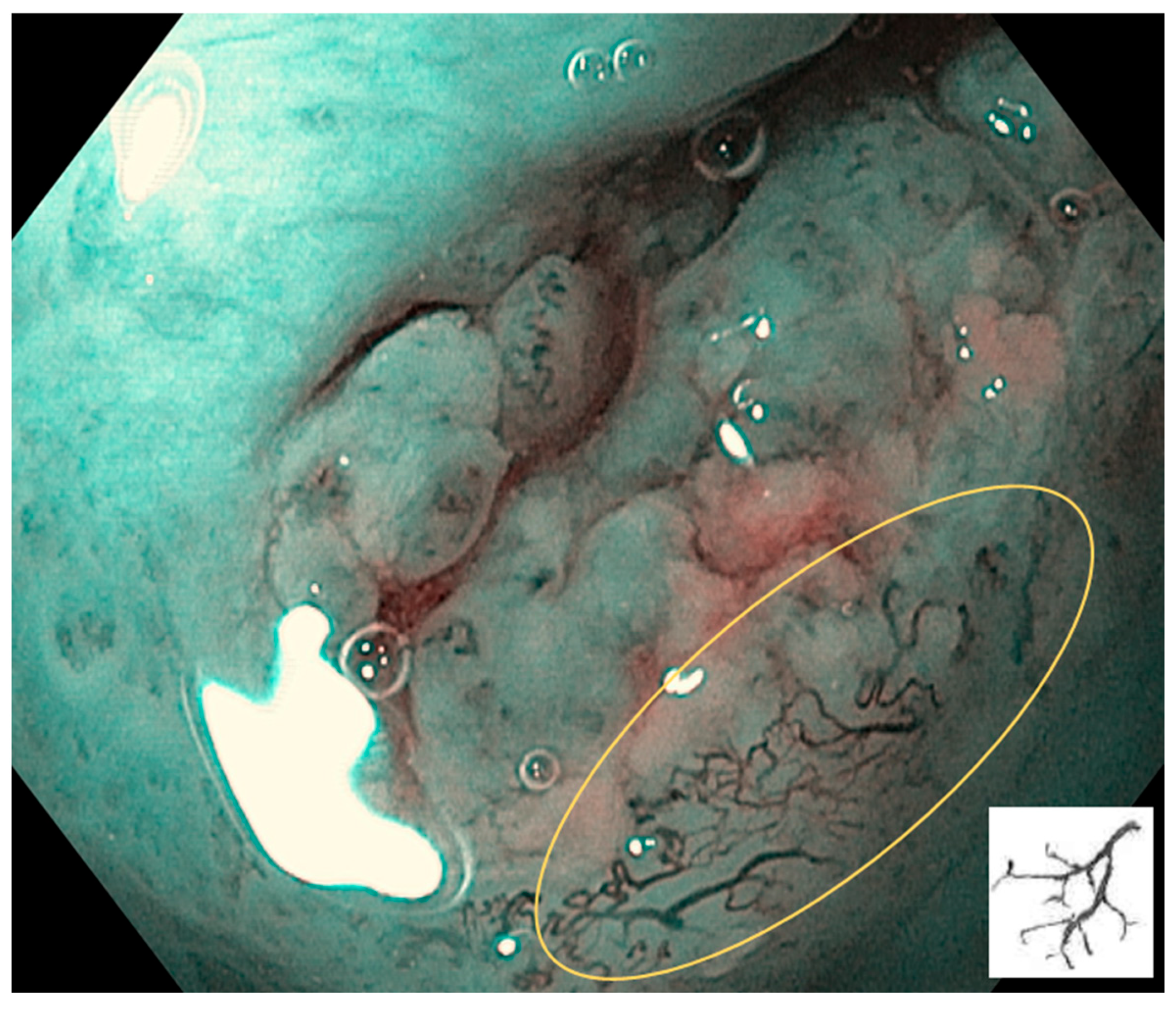 Cancers 17 00021 g005