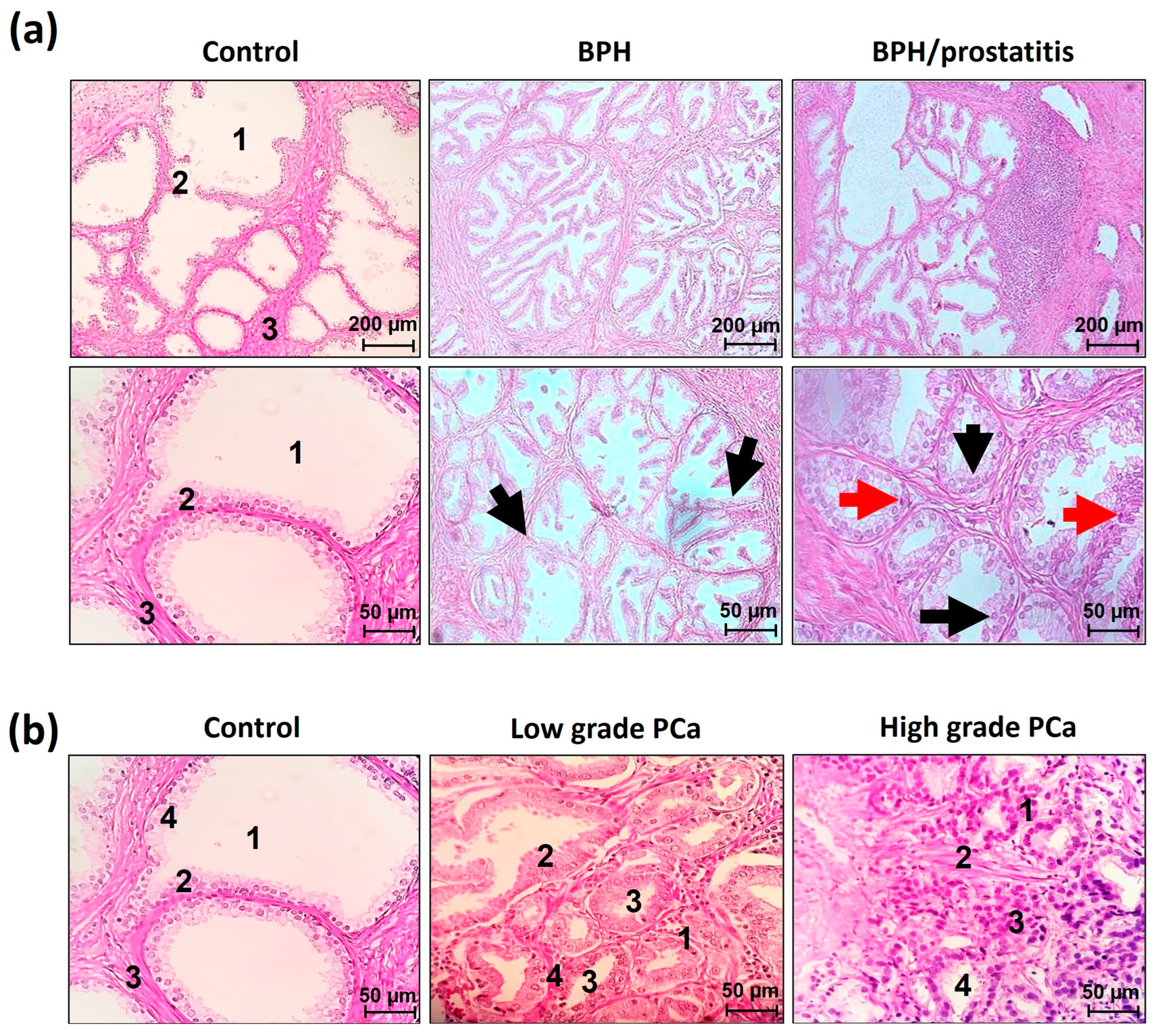 Cancers 17 00026 g001
