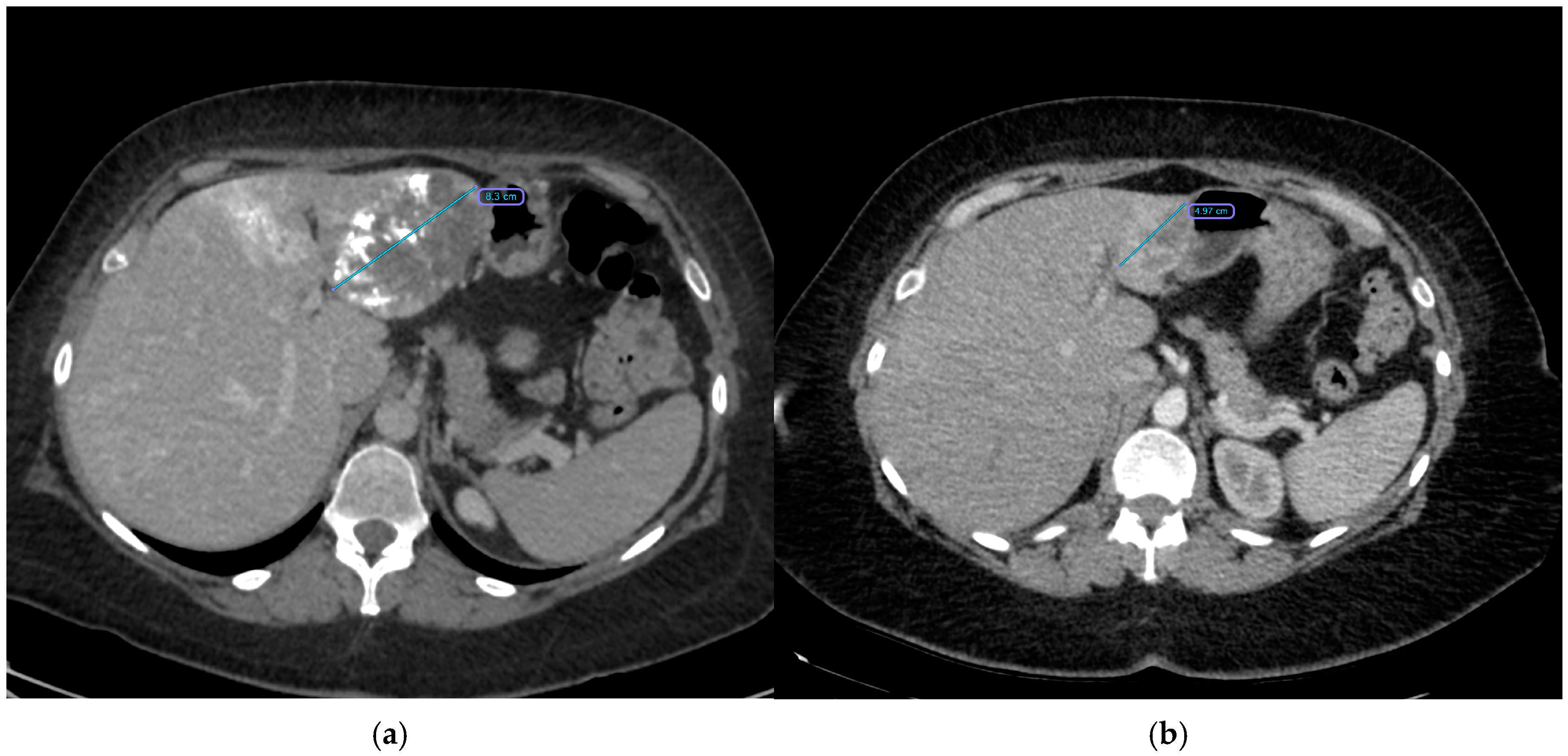 Cancers 17 00042 g004