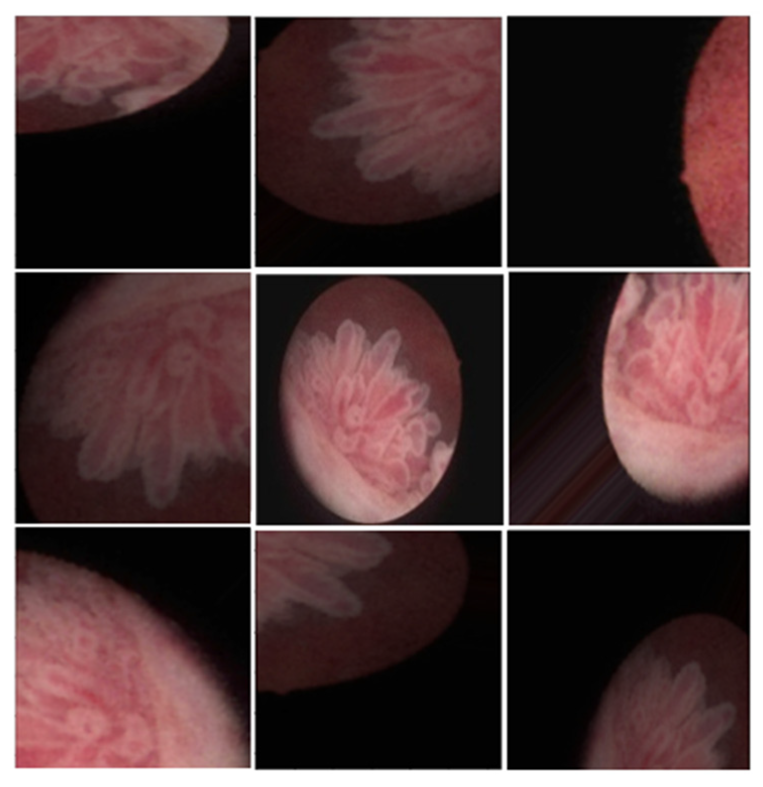 Cancers 17 00057 g002