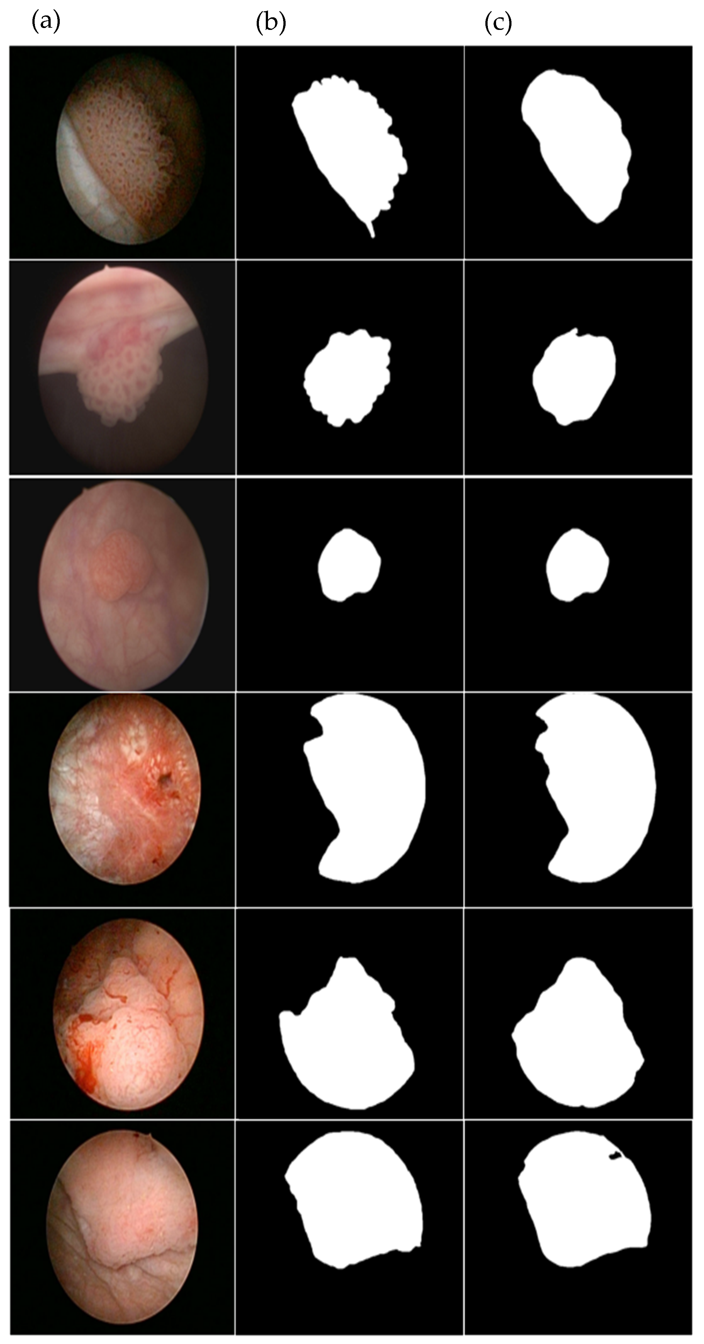 Cancers 17 00057 g004