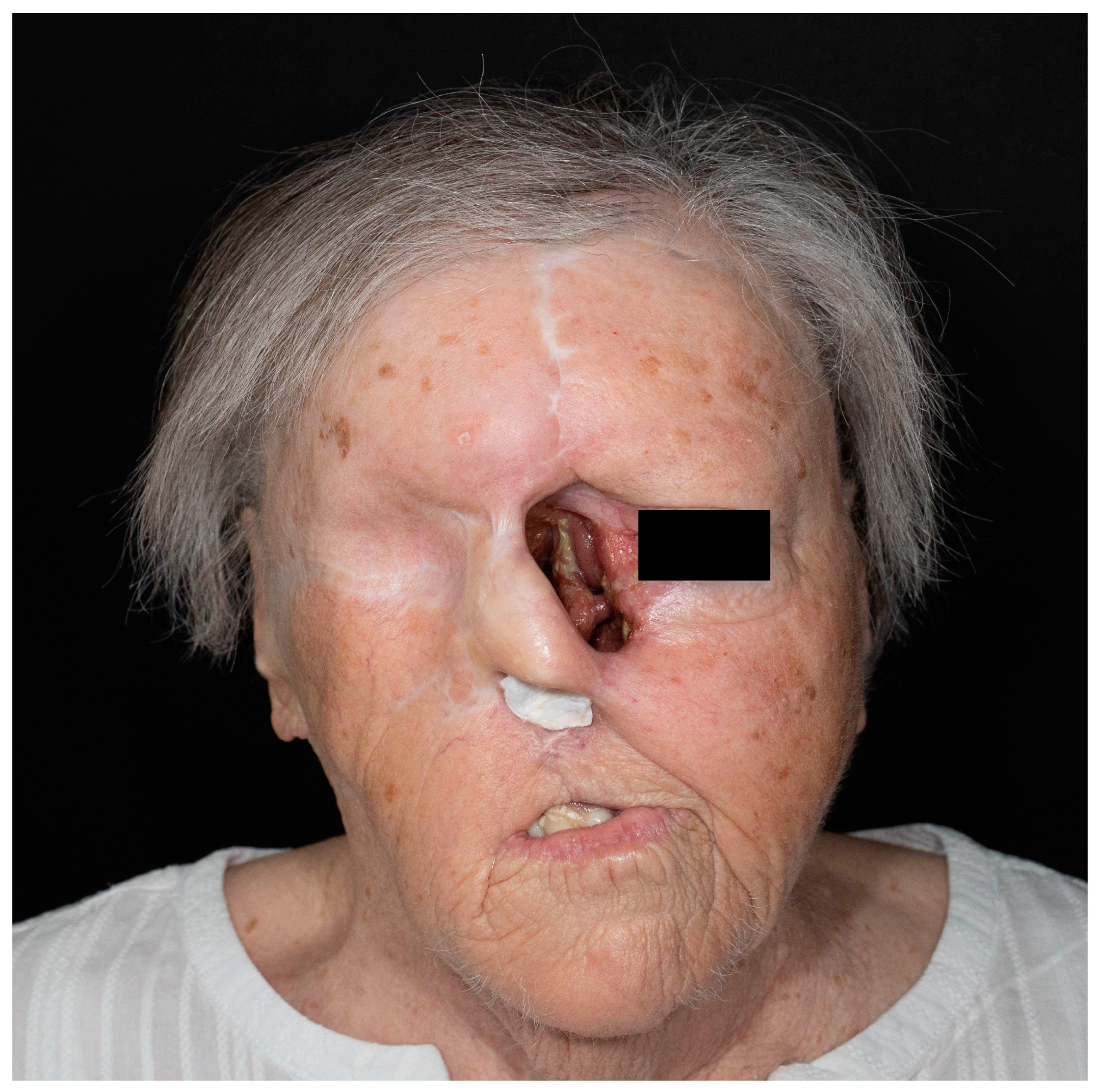 Cancers 17 00068 g003