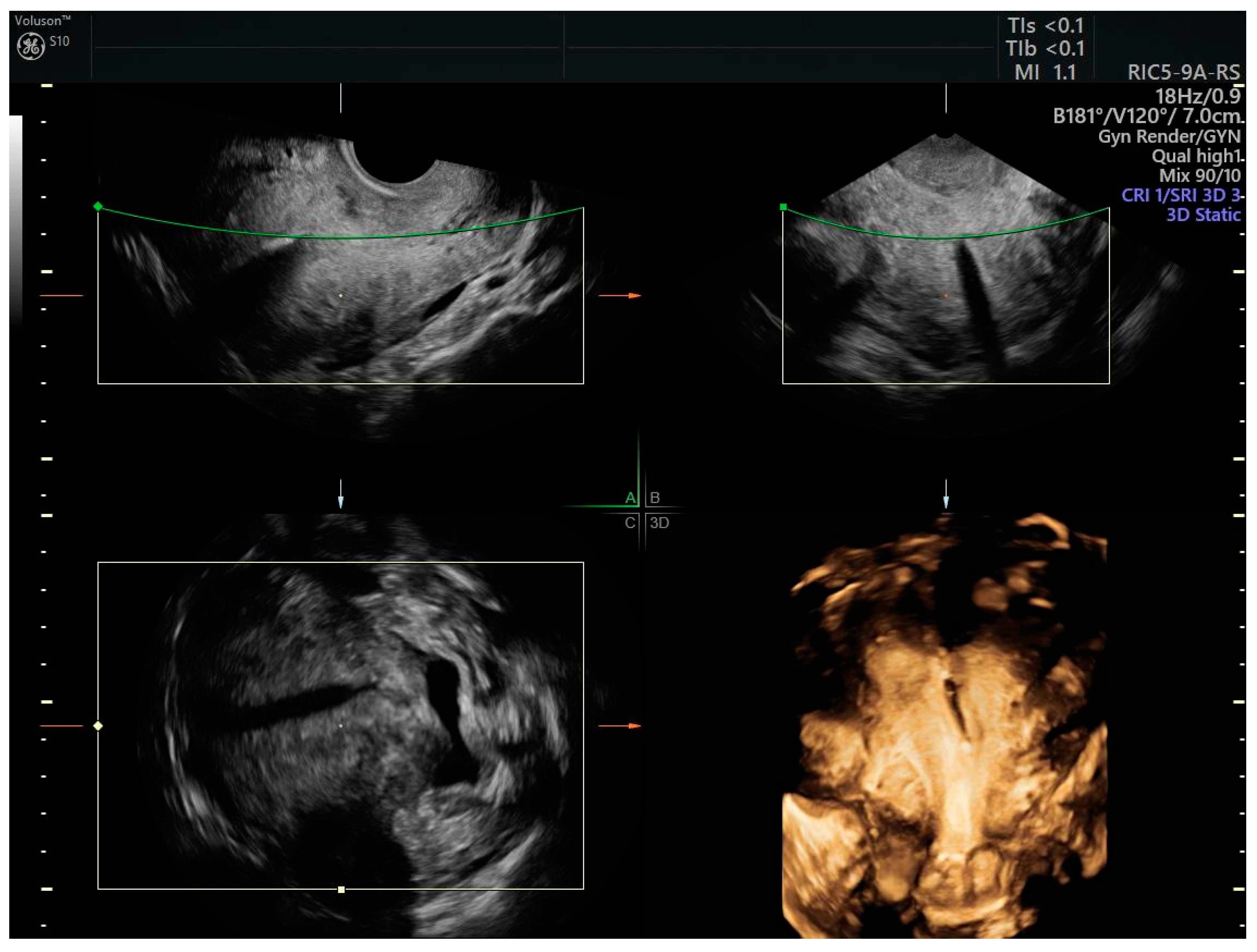 Cancers 17 00112 g002