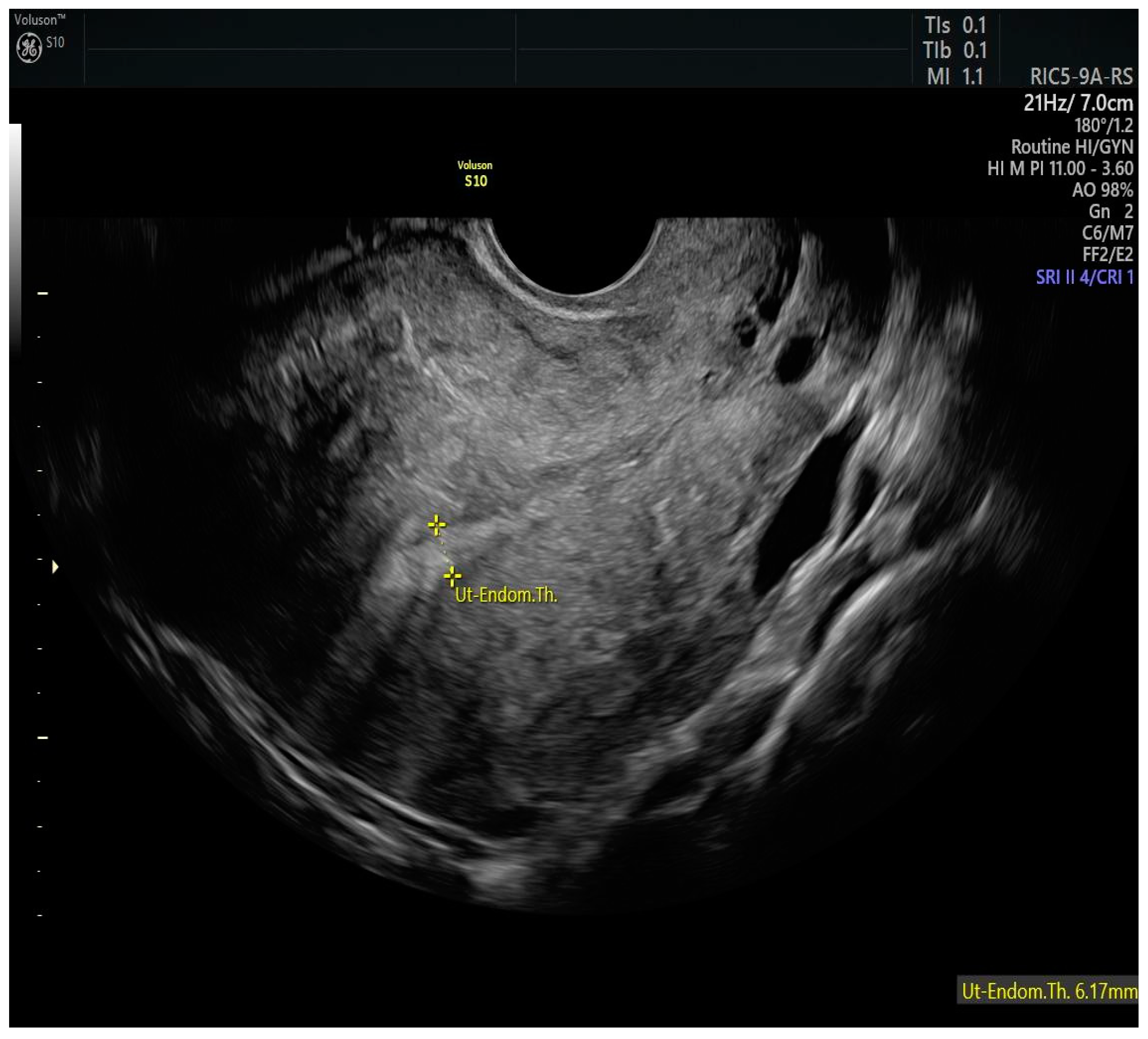 Cancers 17 00112 g004