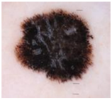 Cancers 17 00137 i001