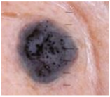 Cancers 17 00137 i002