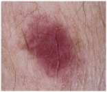 Cancers 17 00137 i003