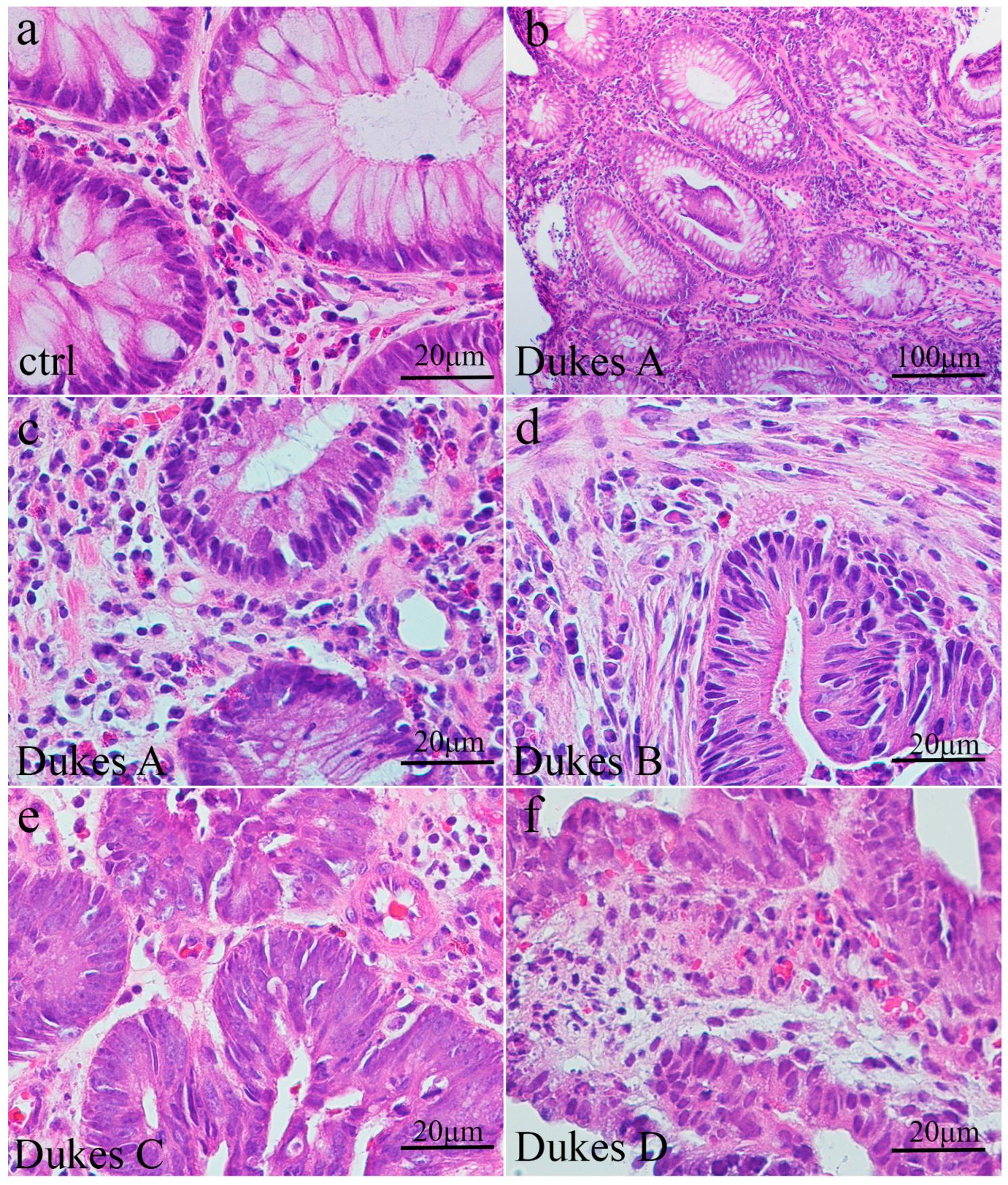 Cancers 17 00166 g001