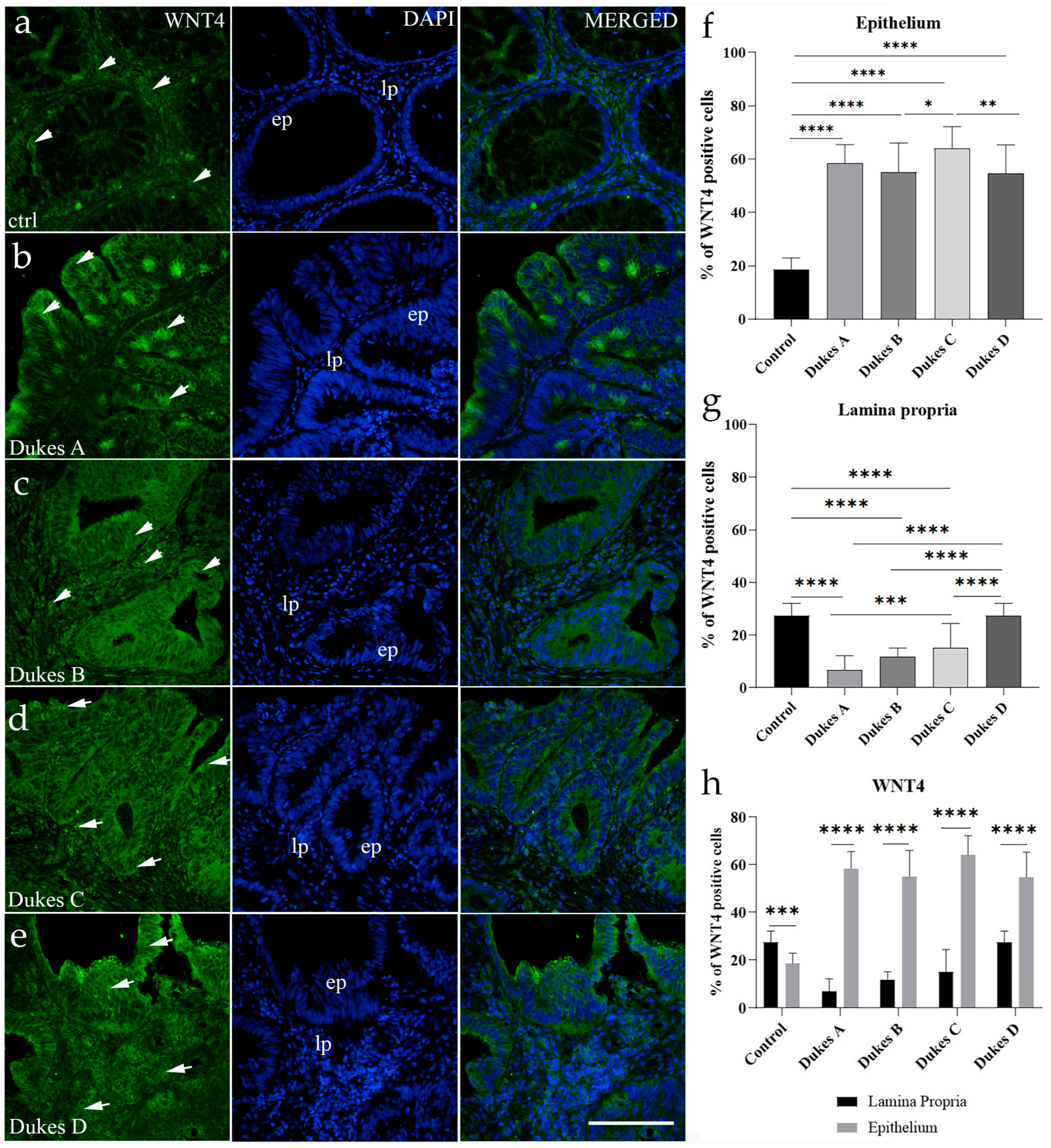 Cancers 17 00166 g004