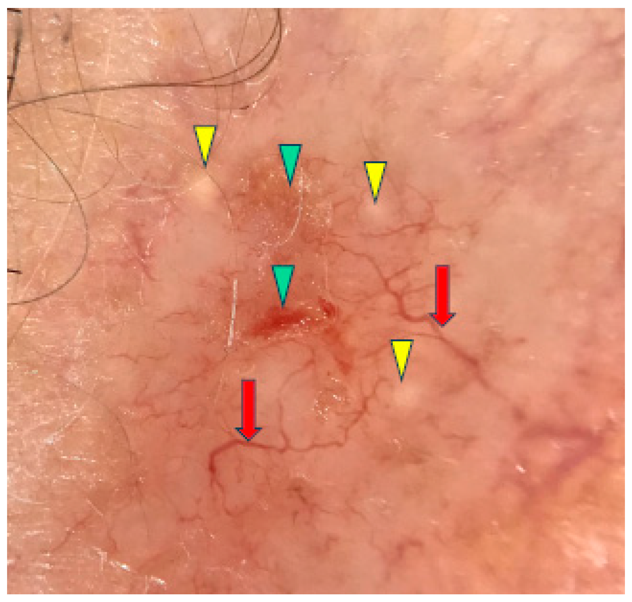 Cancers 17 00176 g002 Cancers 17 00176 g002