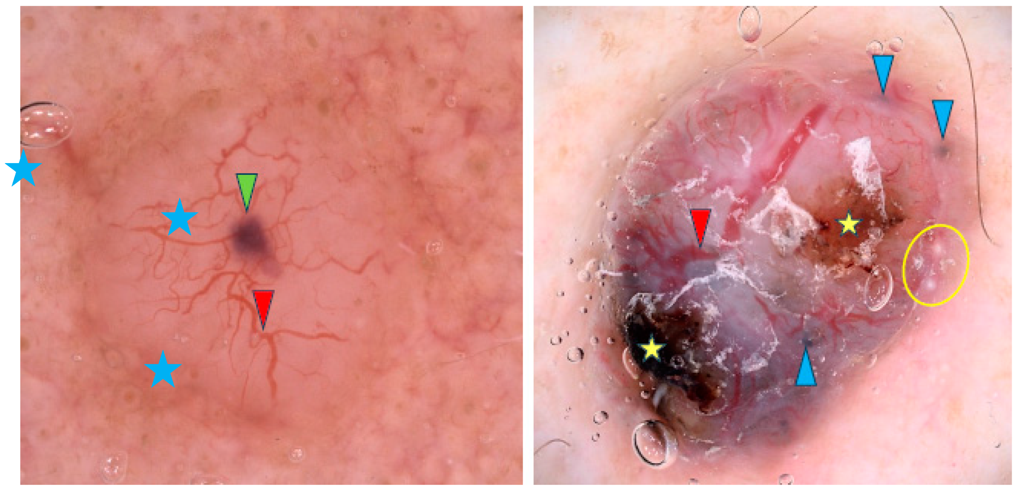 Cancers 17 00176 g003 Cancers 17 00176 g003