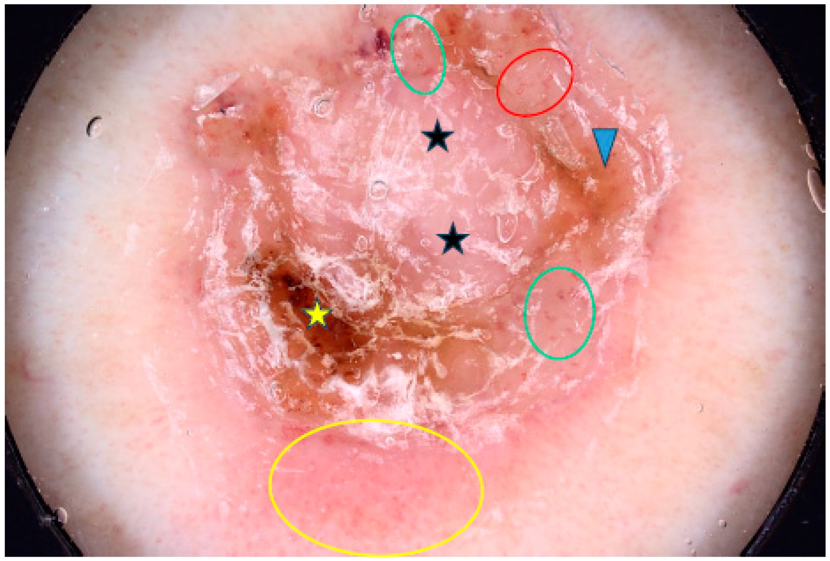 Cancers 17 00176 g007 Cancers 17 00176 g007