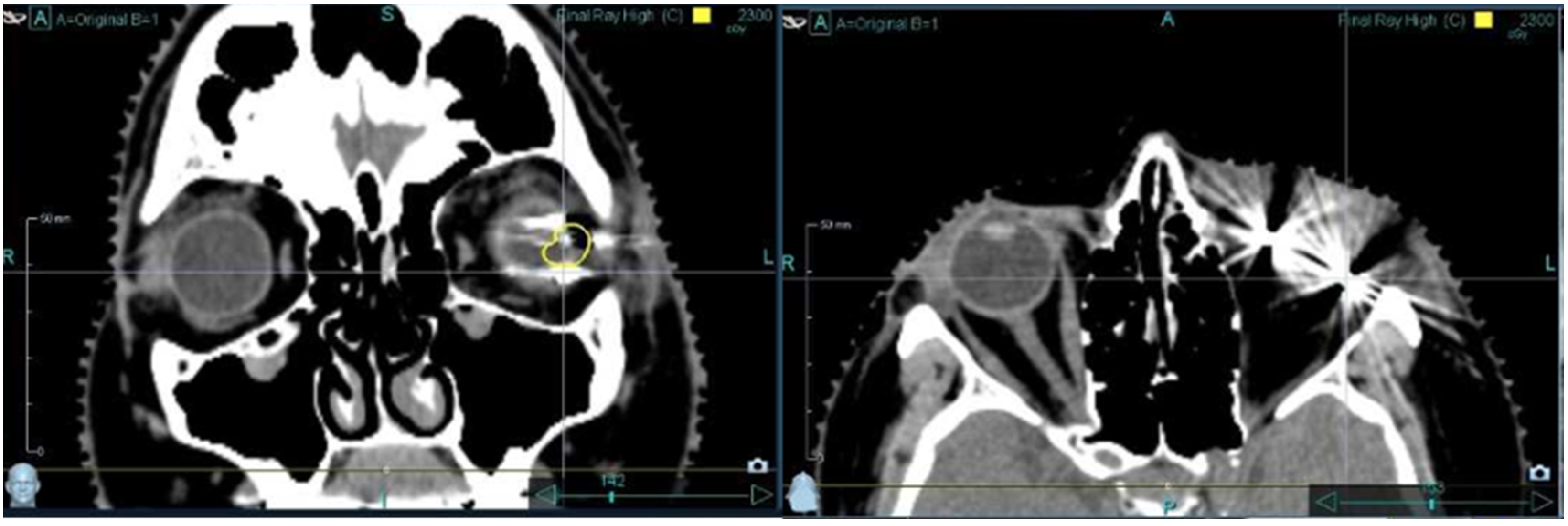 Cancers 17 00189 g001