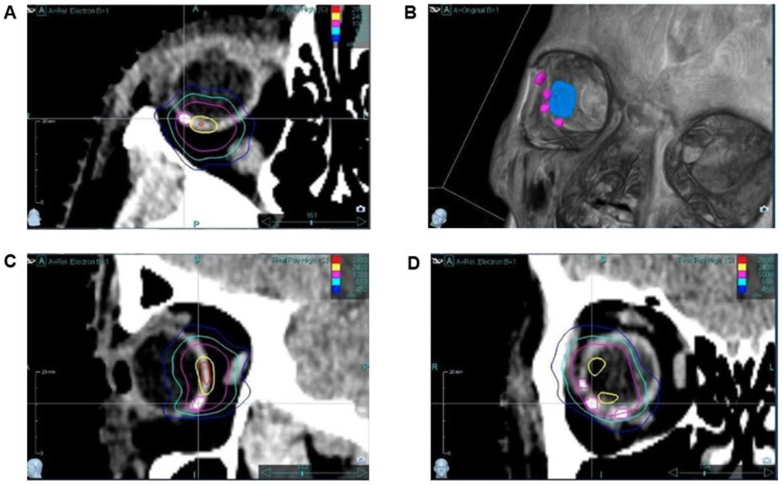 Cancers 17 00189 g003